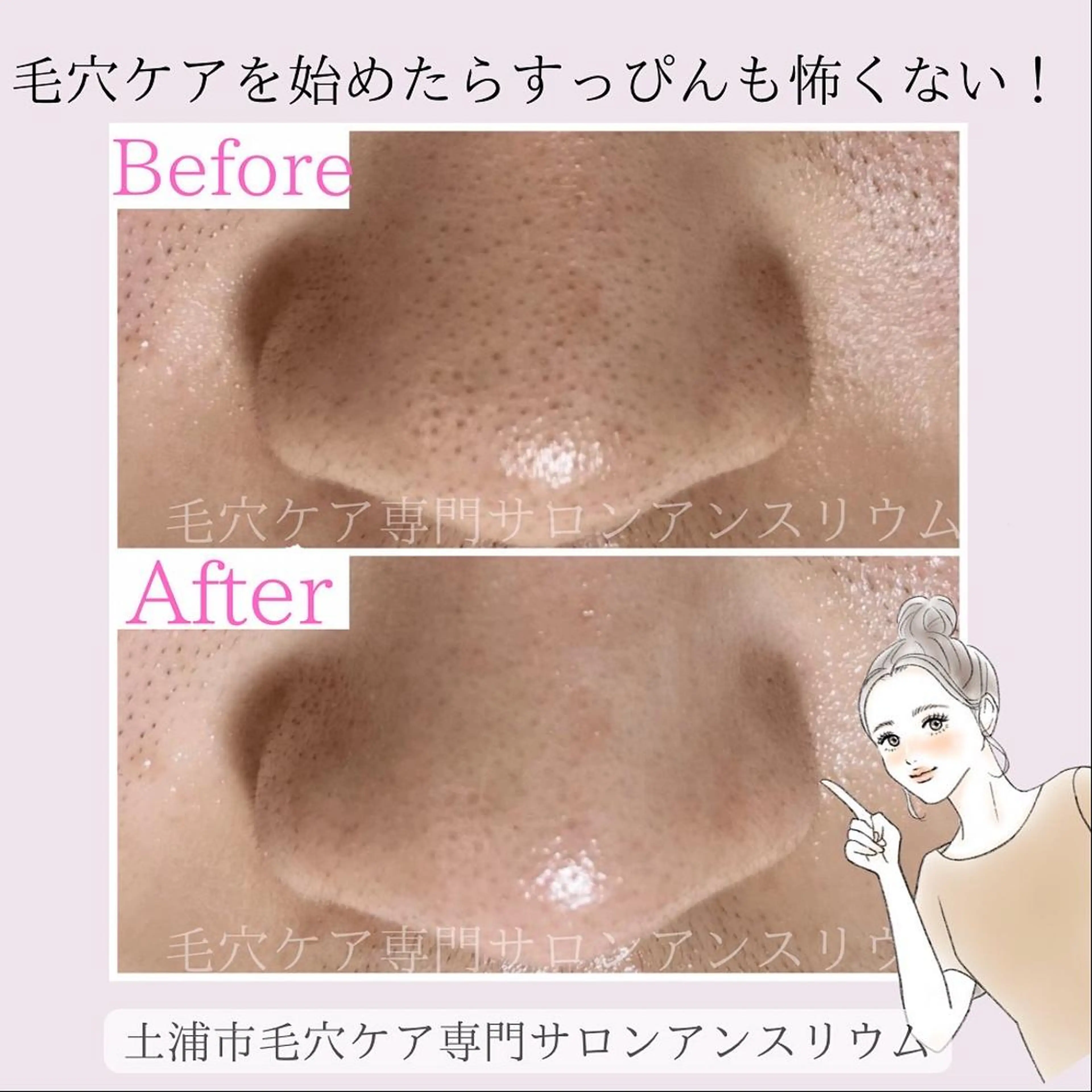 茨城土浦 つくば毛穴 ケア専門サロンのエステ・リラクイメージ