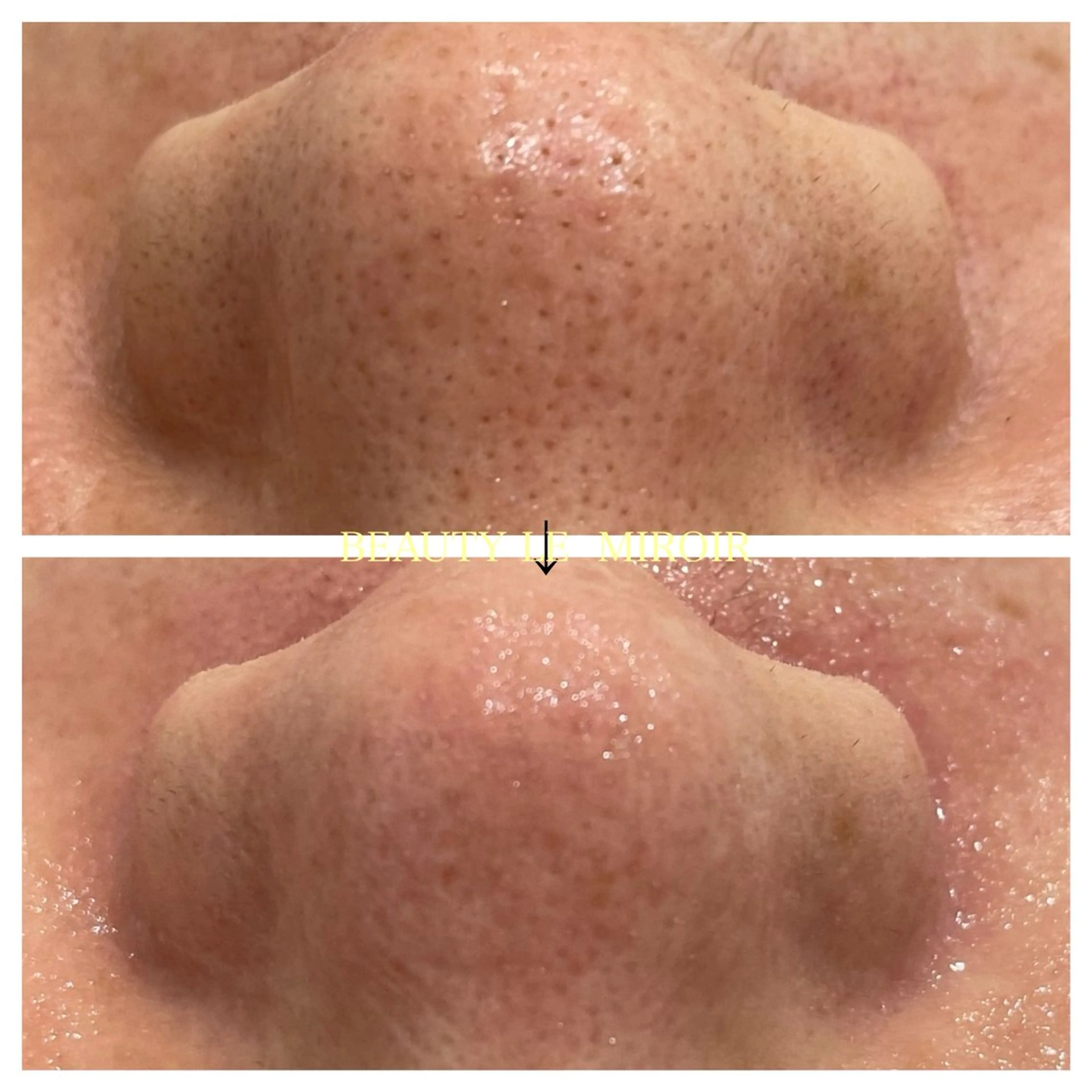 エステ ビューティー ミロワールのエステ・リラクイメージ