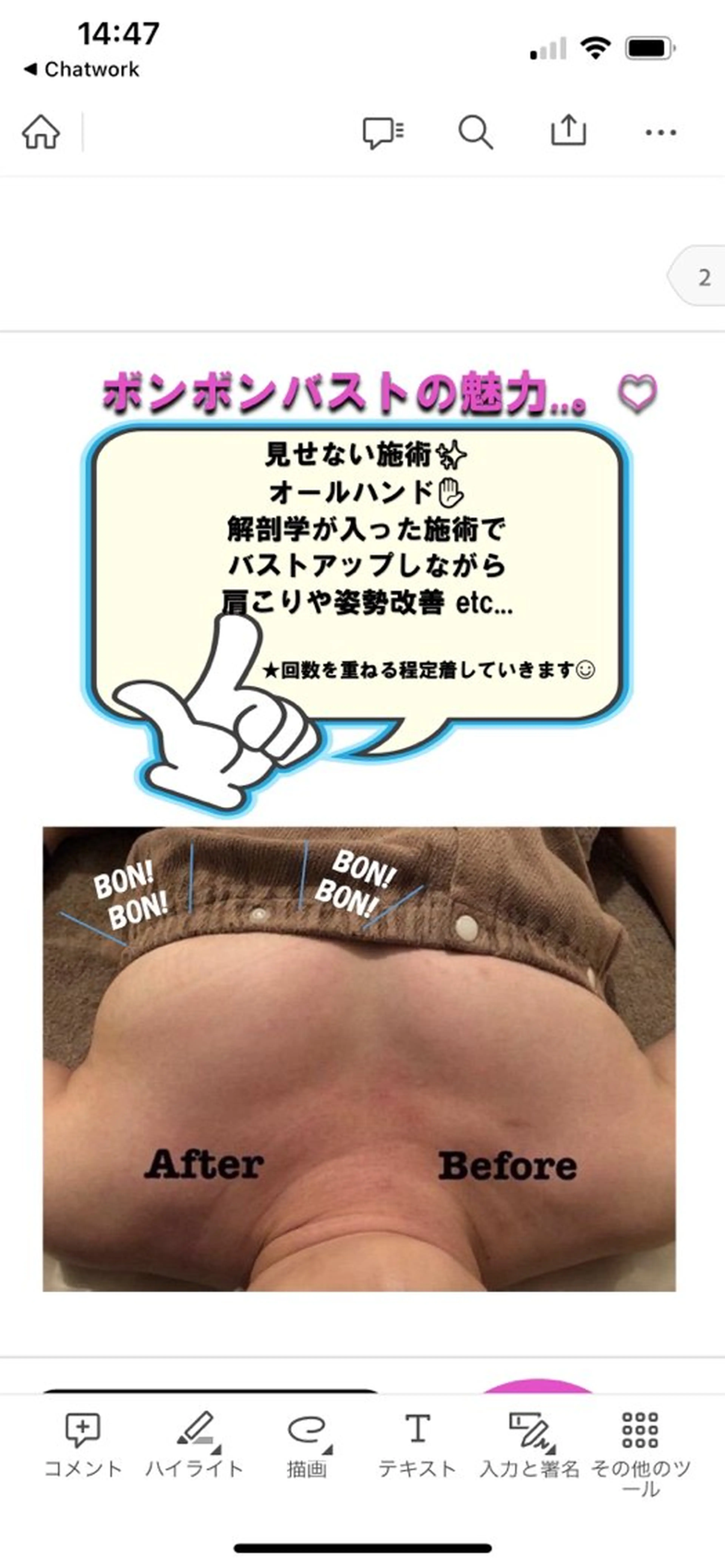 エステ Bevi salonのその他イメージ