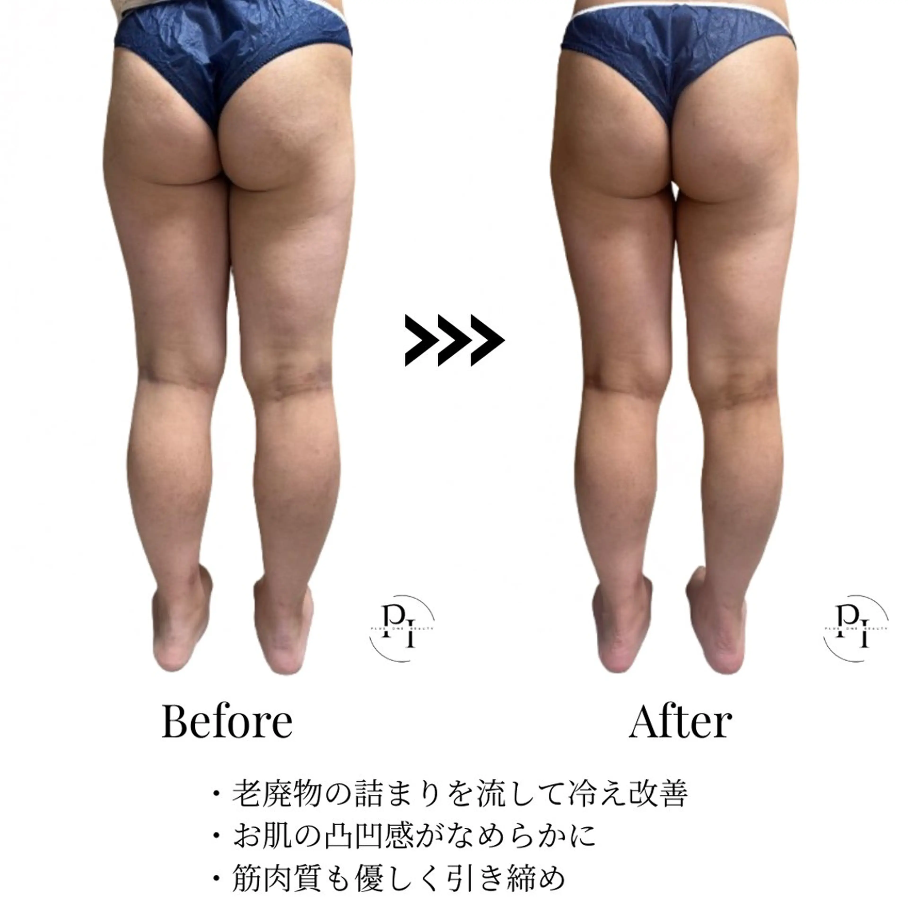 Plus One Beauty所属・【新大阪】痩身/小顔 美肌フェイシャルのエステ・リラクイメージ