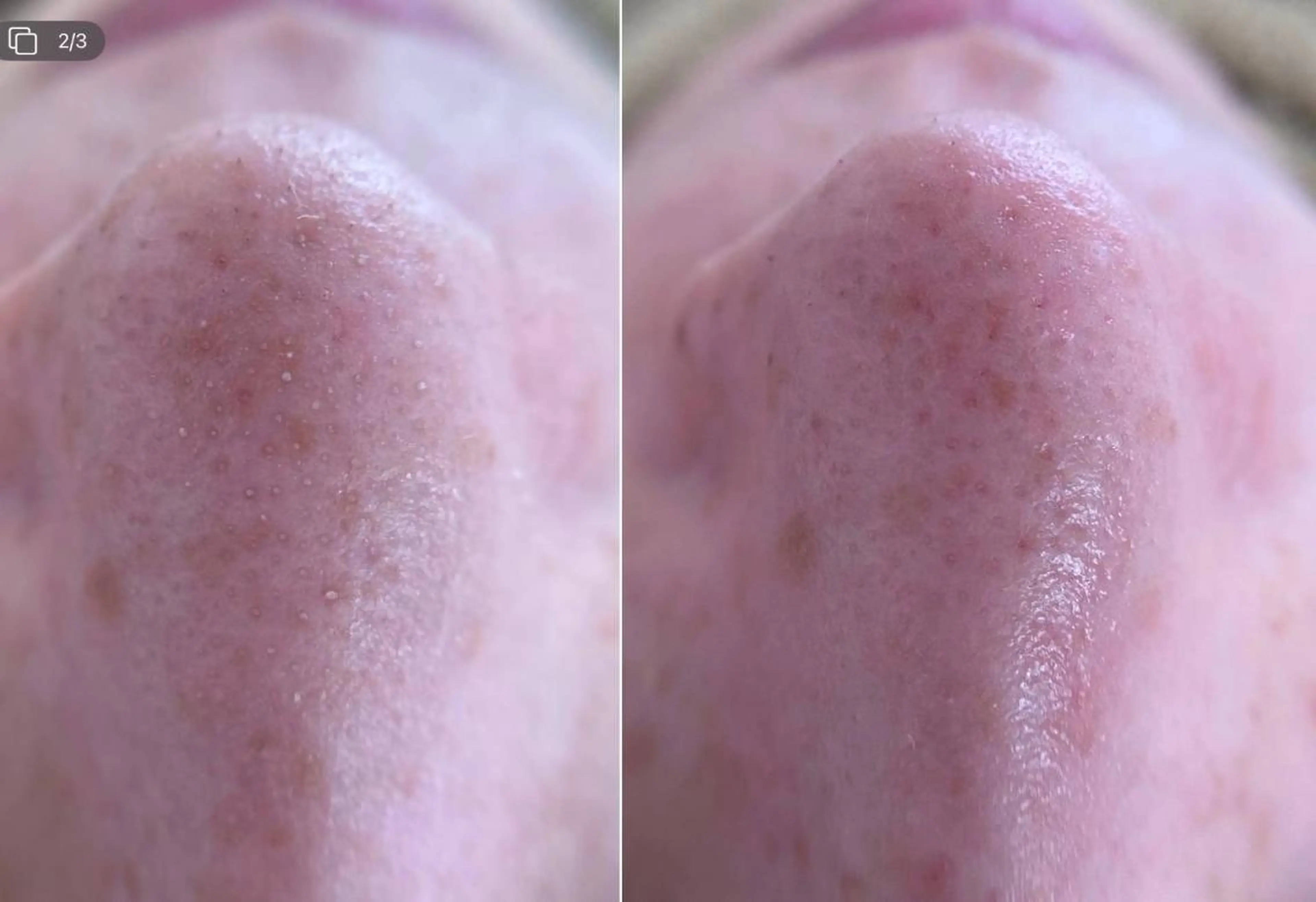 エステ 小林 理恵のエステ・リラクイメージ