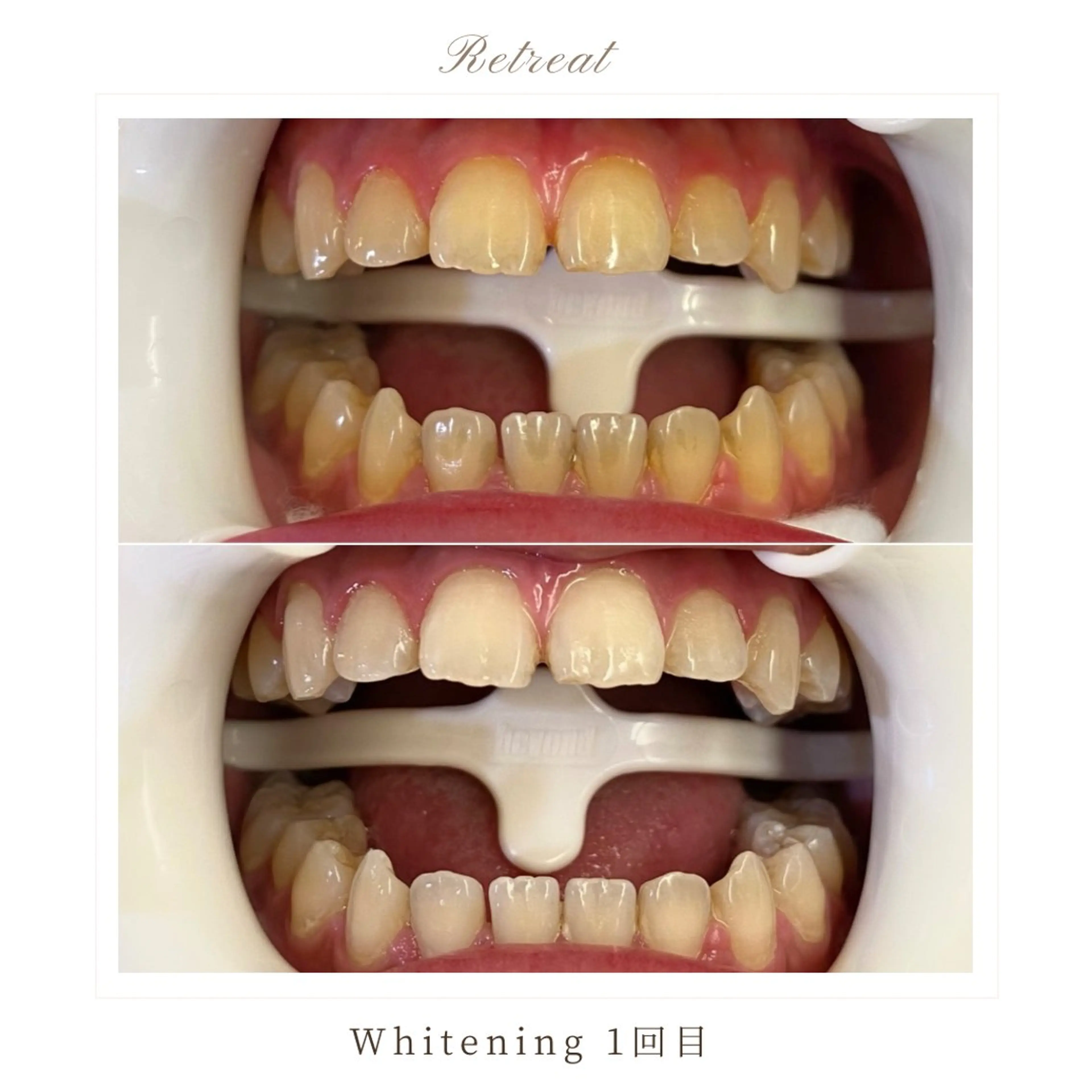 メンズ キッズ Retreatリトリート所属・歯科医院提携 Retreatのエステ・リラクイメージ