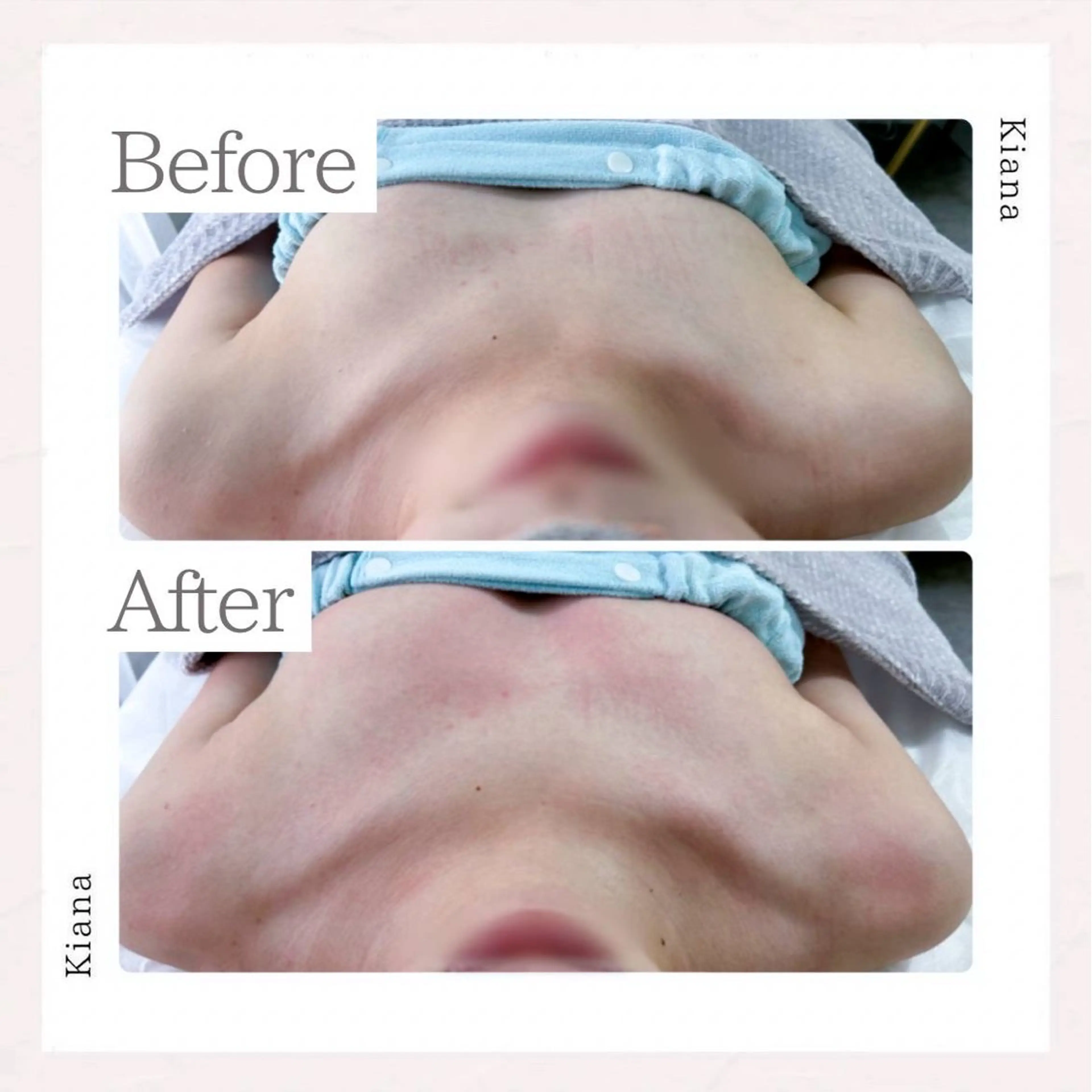 エステ リラク バスト専門Kiana 風のエステ・リラクイメージ