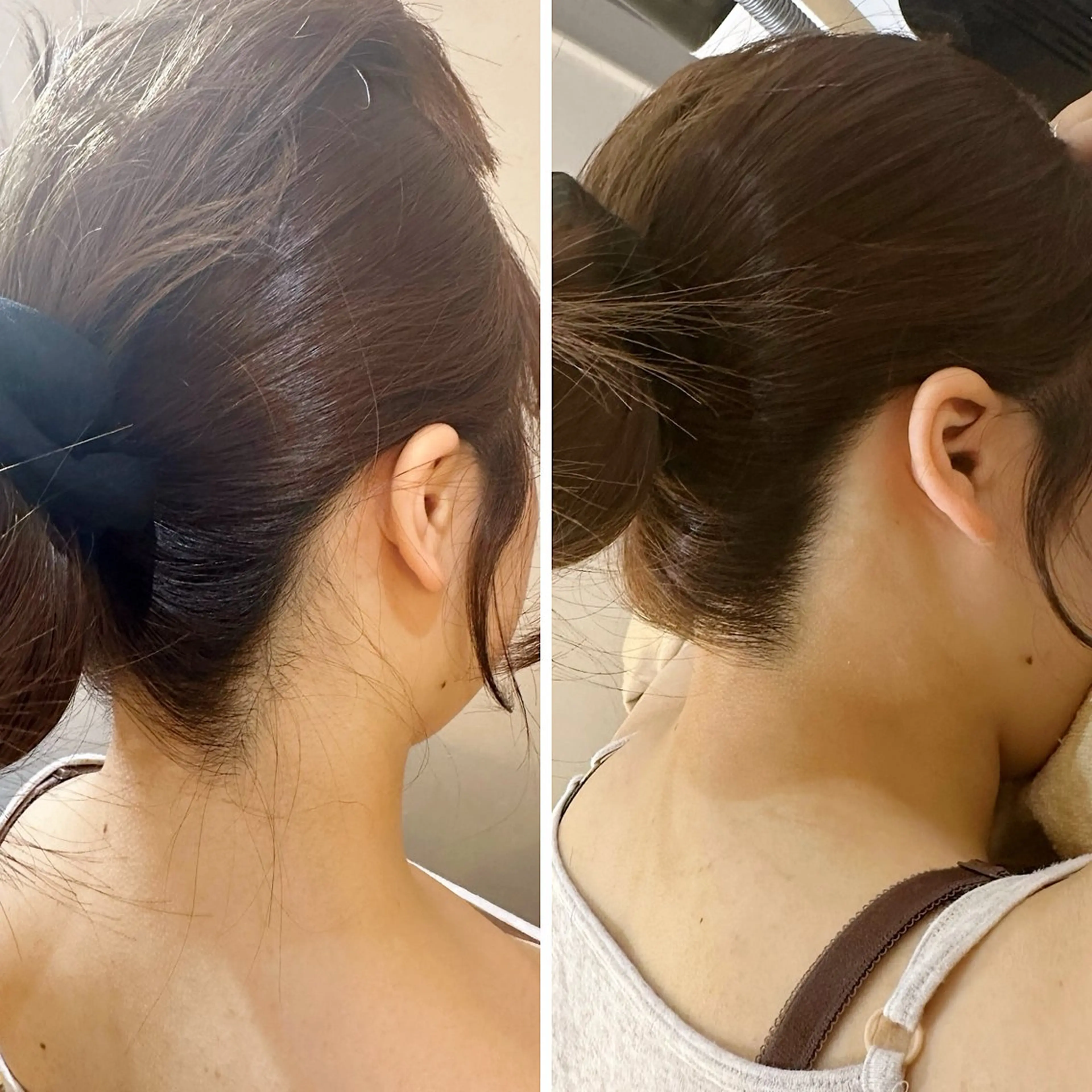 脱毛 うなじ脱毛/美肌脱毛 LABELのエステ・リラクイメージ