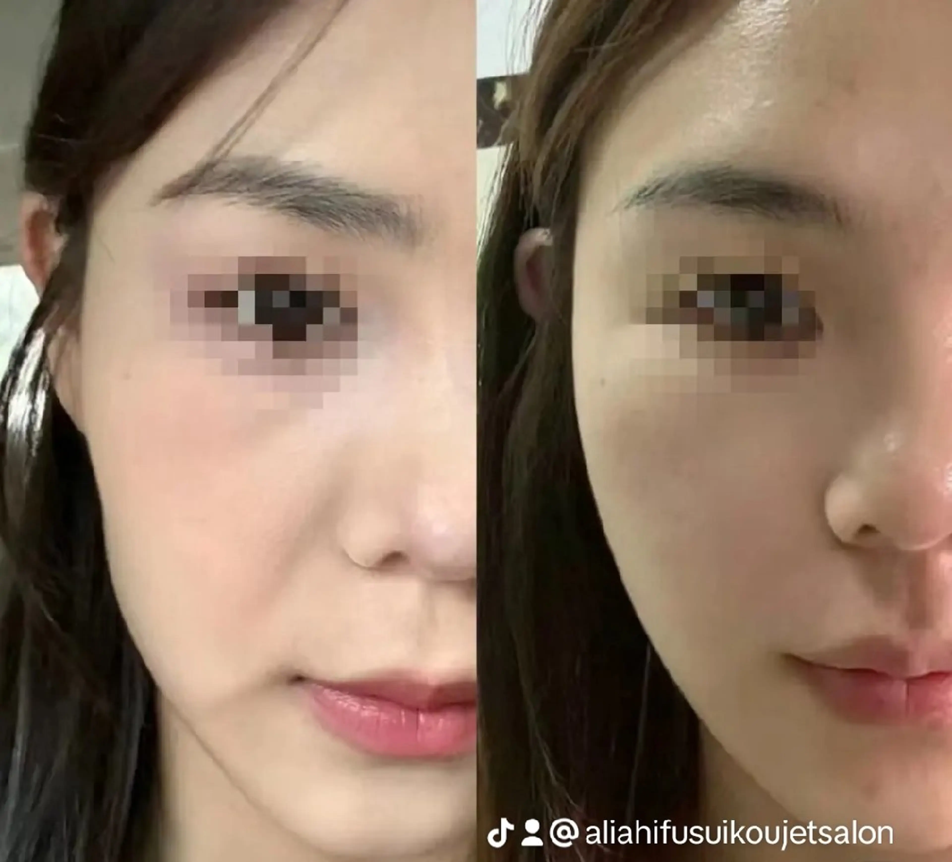 ネイル ブライダルネイル aliaハイフ&水光ジェットサロン所属・aliaハーブ水光店 エステティシャン募集のエステ・リラクイメージ