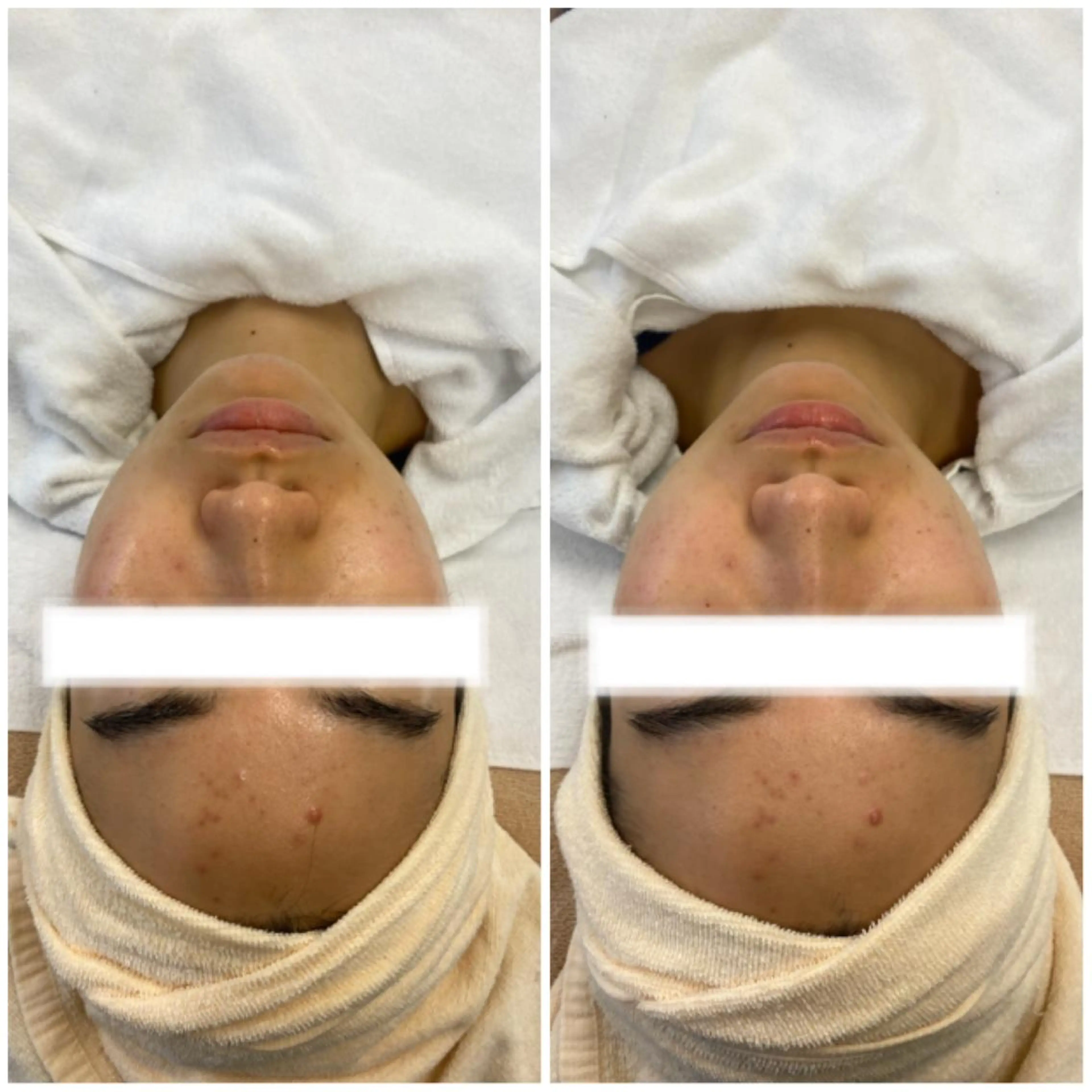 アイブロウ 肌質改善美容サロン ému 用賀のエステ・リラクイメージ