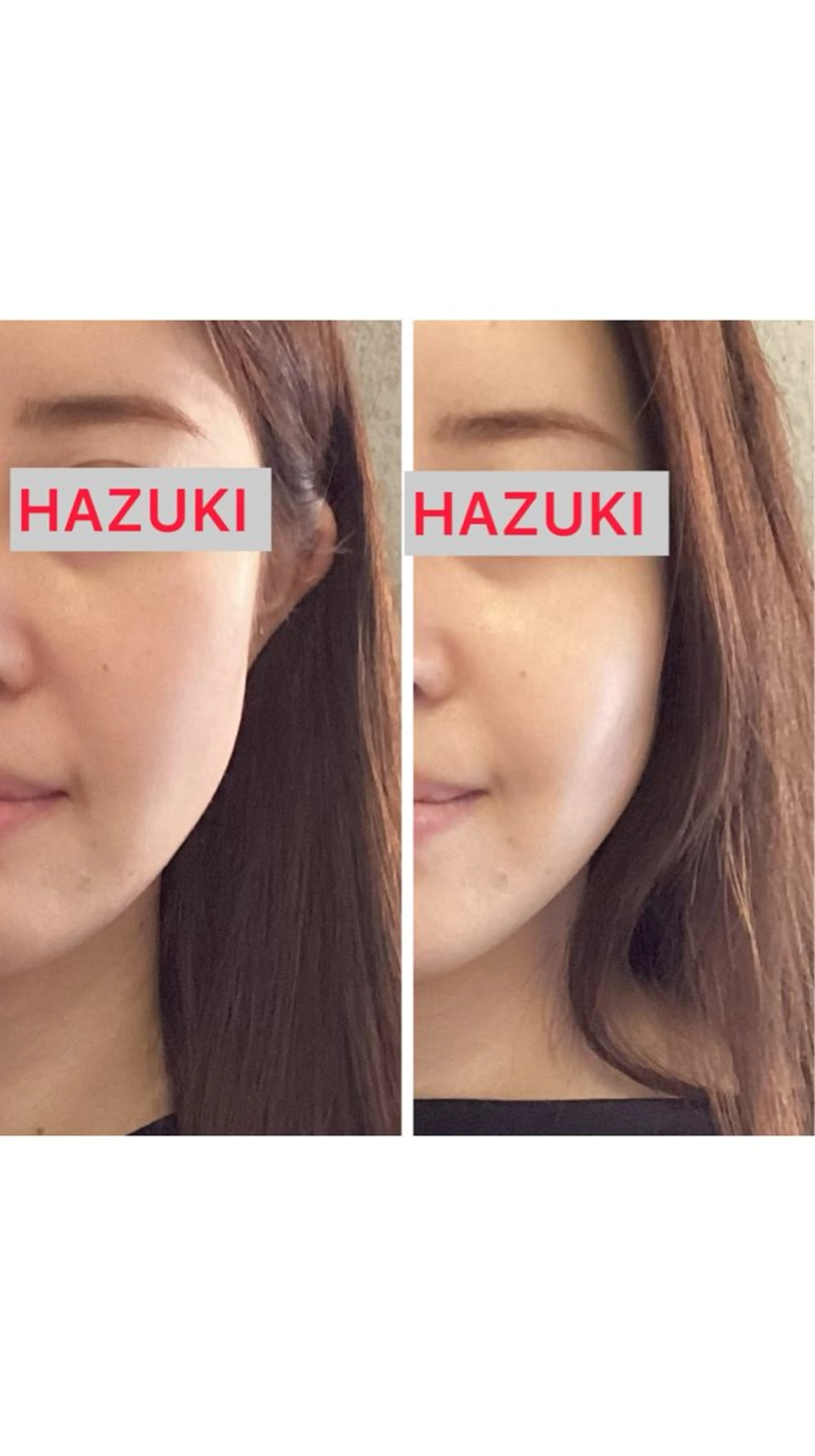 たるみ改善小顔エステ 堀葉月のその他イメージ