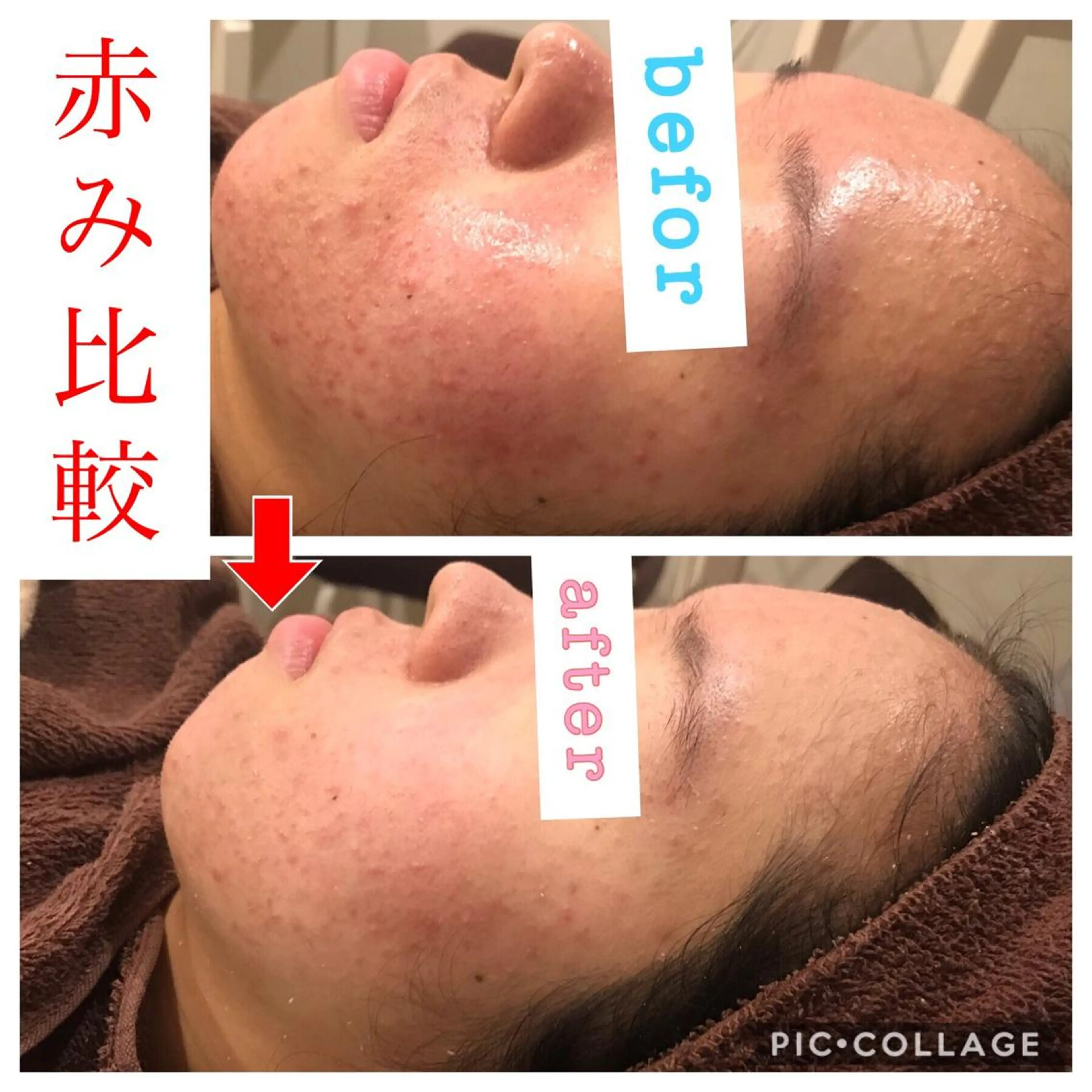 セミロング カラー パーマ ヘアアレンジ メンズ キッズ ネイル マツエク・マツパ 金の糸脱毛 産毛ケア専門のエステ・リラクイメージ