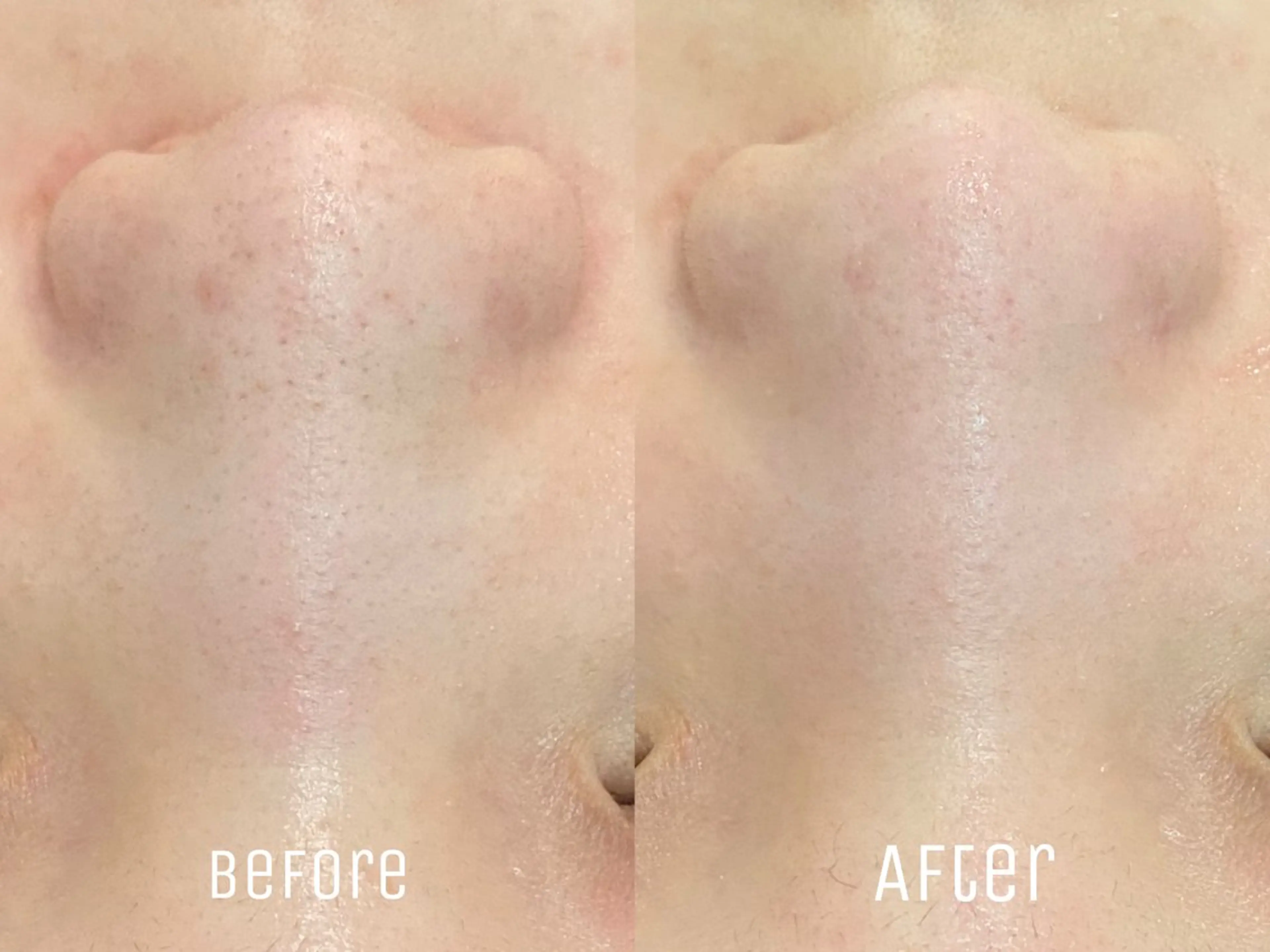 エステ ニキビ・毛穴・肌荒れ &me 西宮北口店のその他イメージ