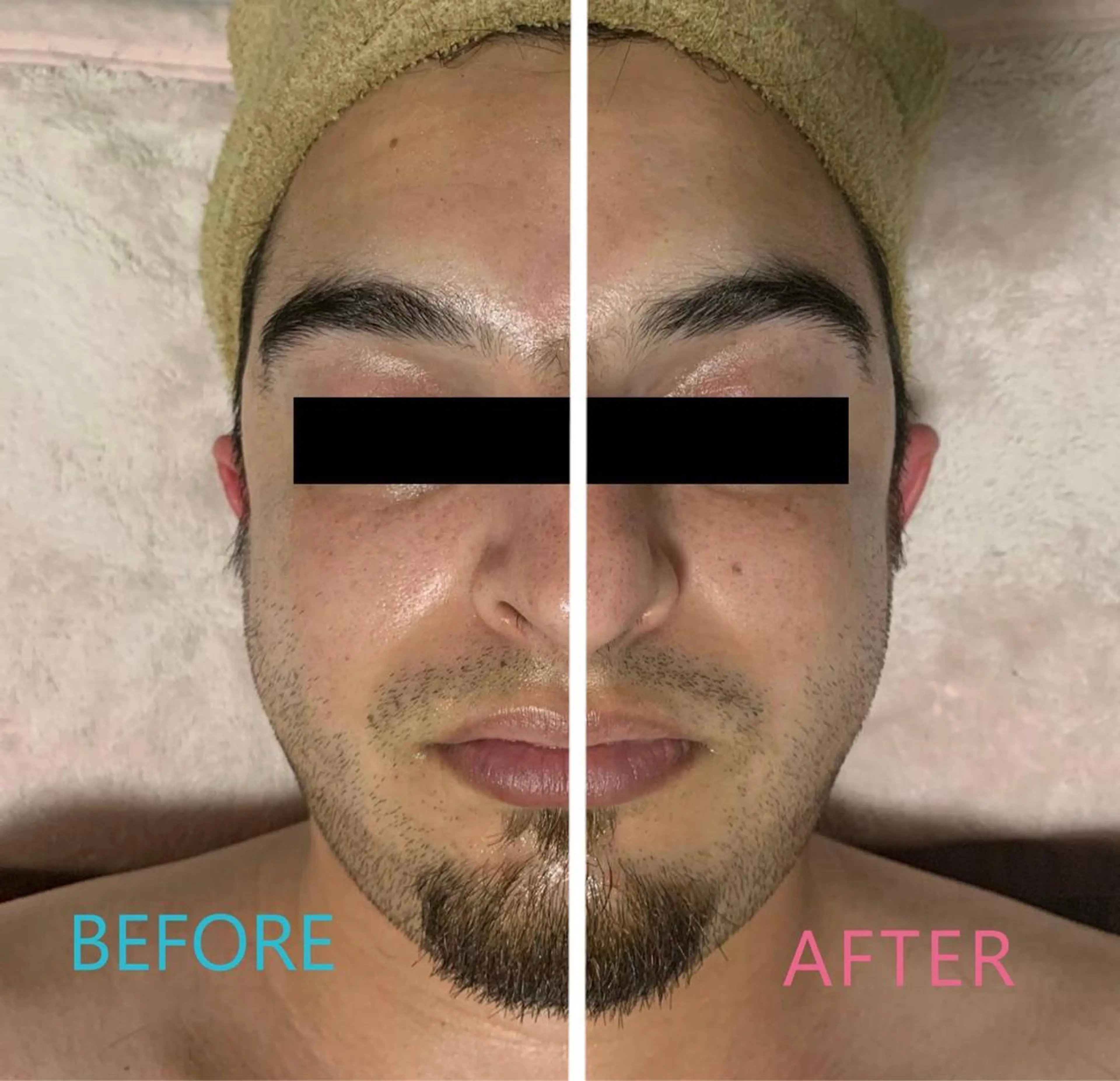 ハウオリベリー所属・うえば すみかのエステ・リラクイメージ