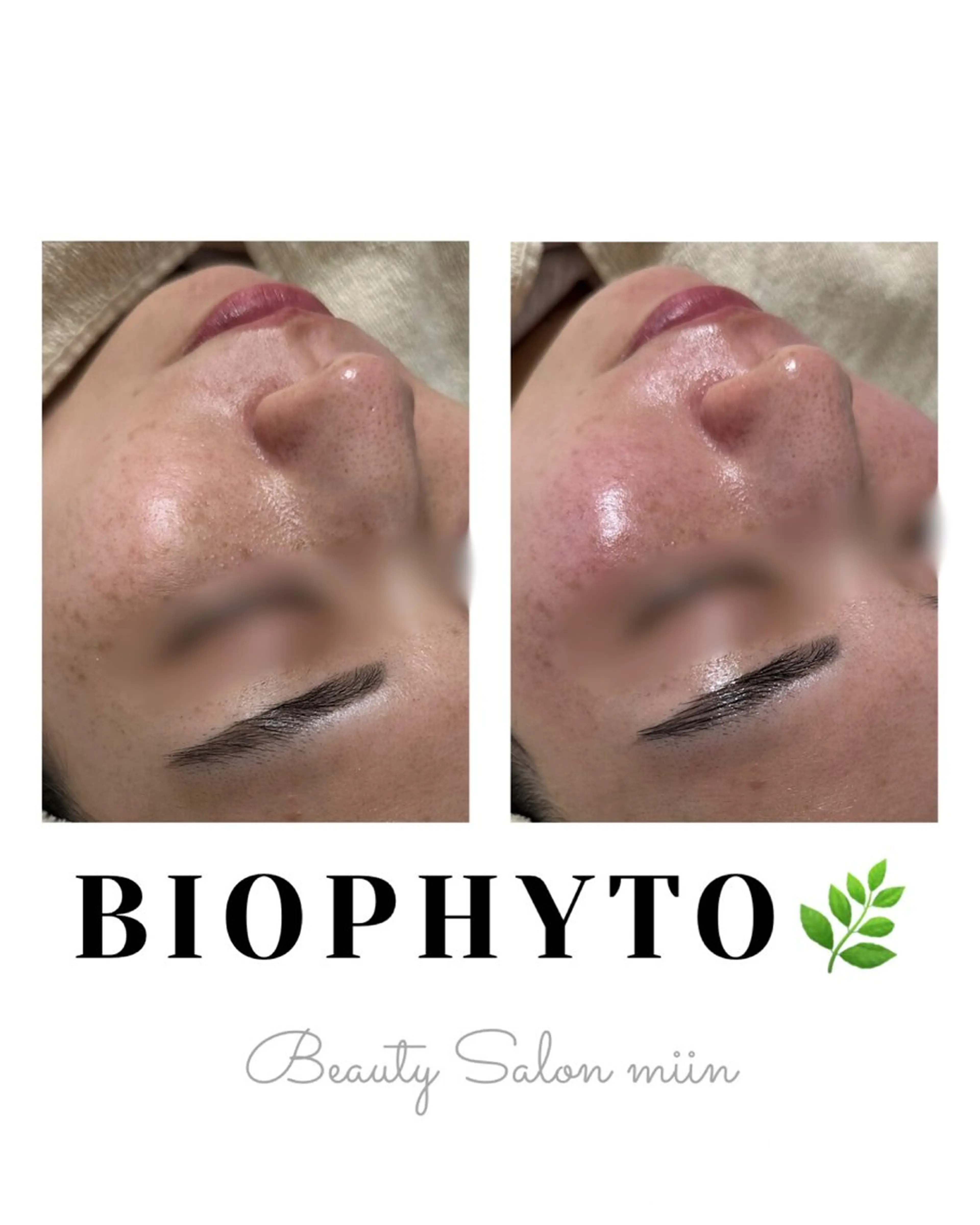 エステ 韓国肌管理 白玉肌管理®︎のエステ・リラクイメージ