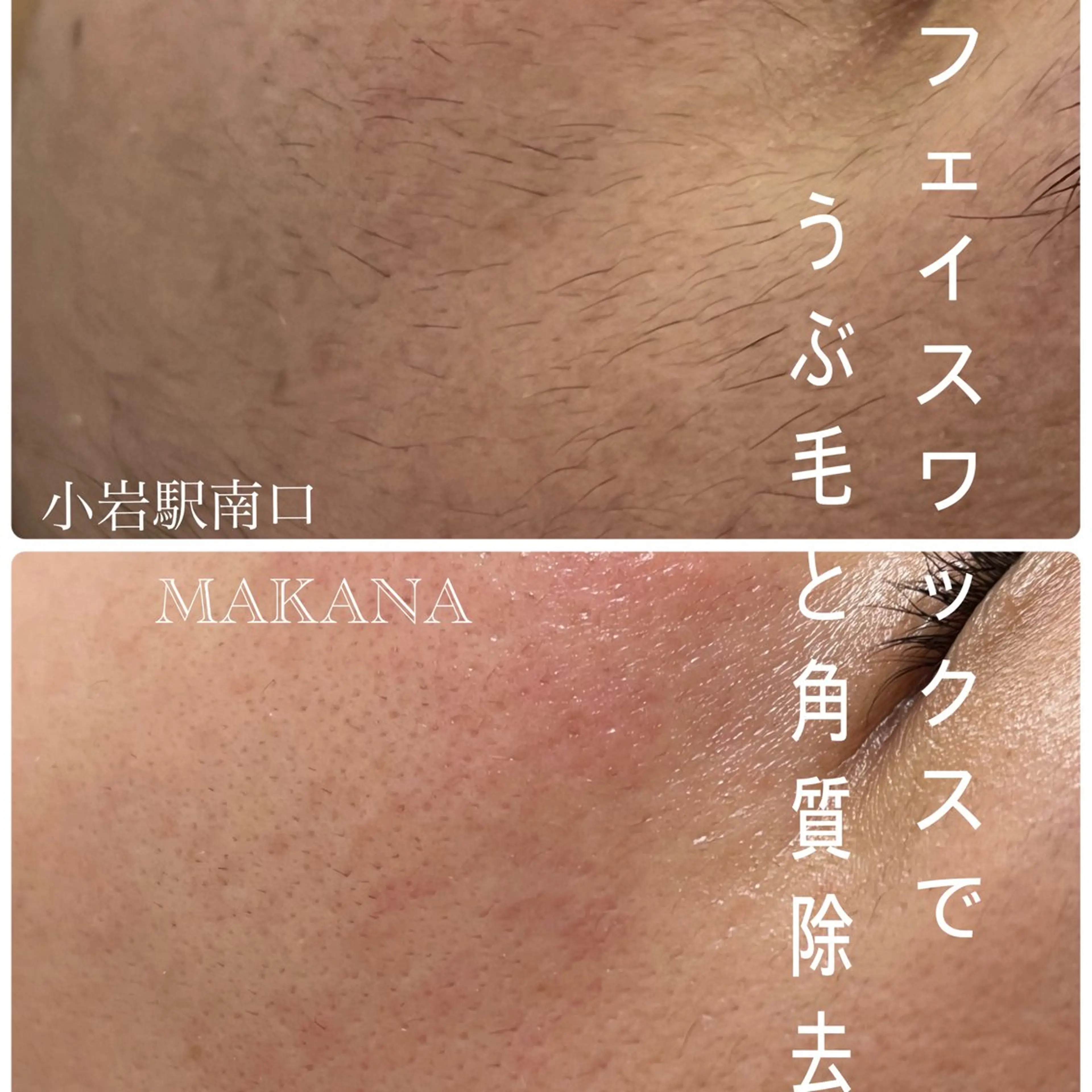 ワックス脱毛 眉カット その他(アイブロウ) MAKANA 吉岡 小岩店のエステ・リラクイメージ