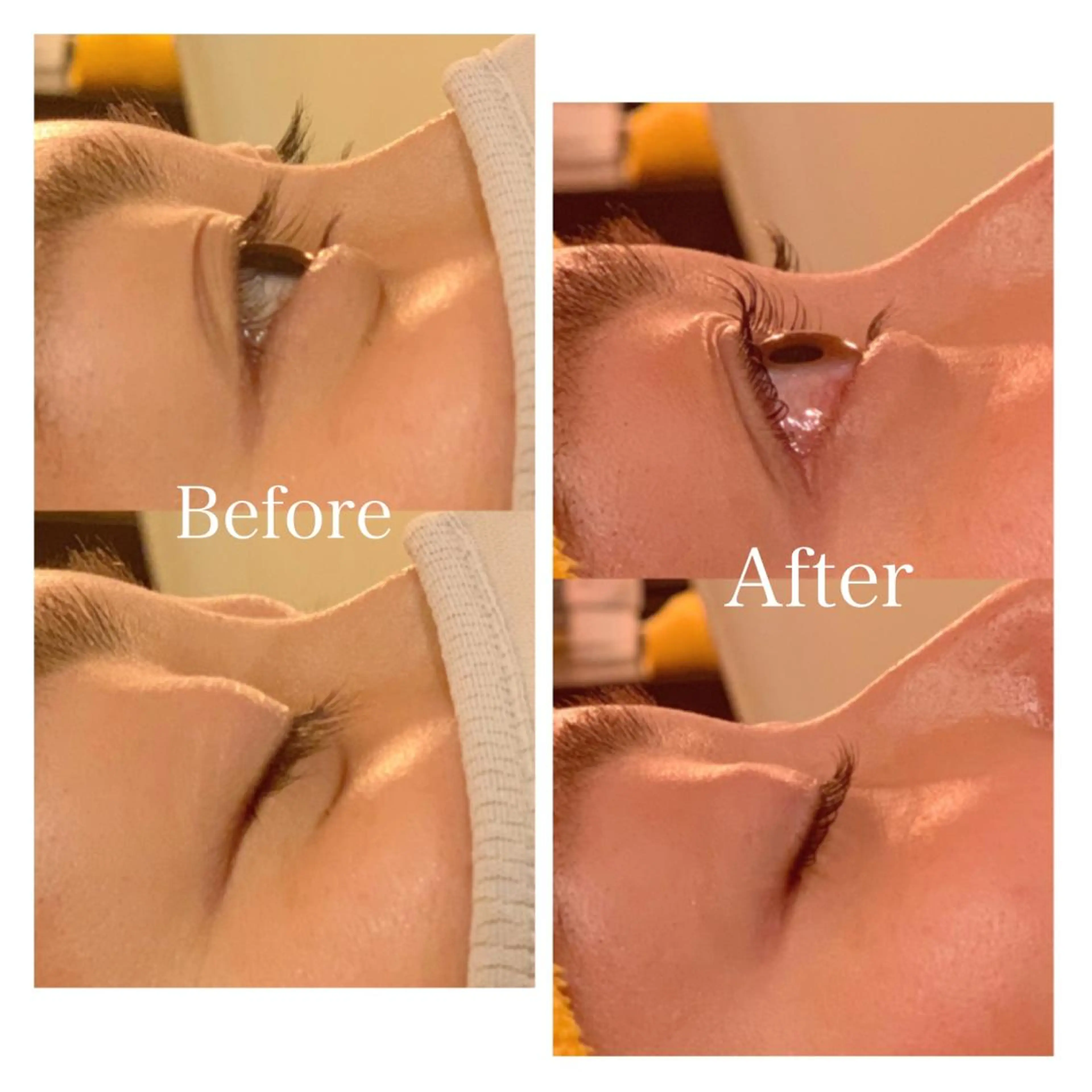 マツエク・マツパ 西岡 美香子のネイルデザイン