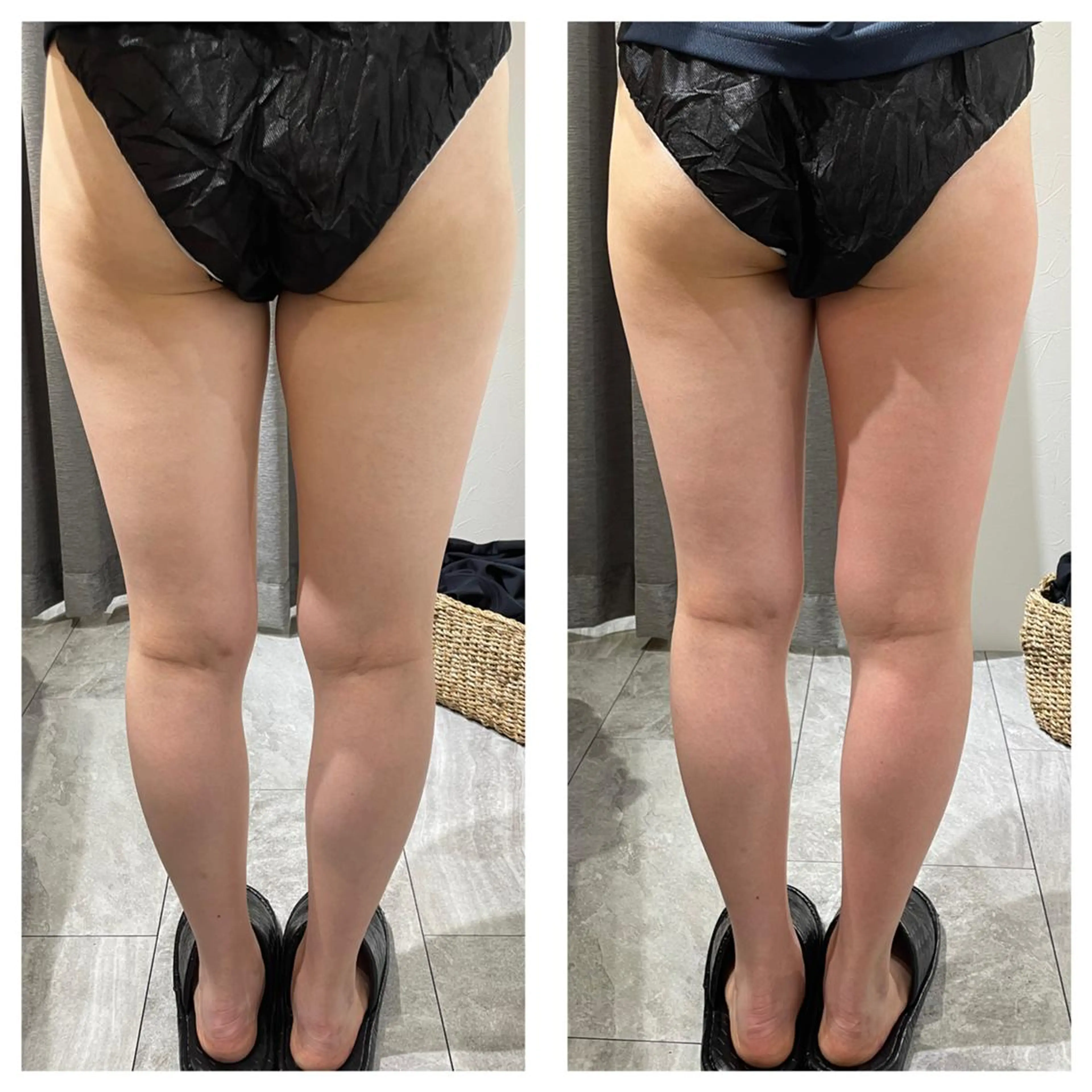 エステ リラク 部分痩せ♥️小顔専門 MIKUのエステ・リラクイメージ