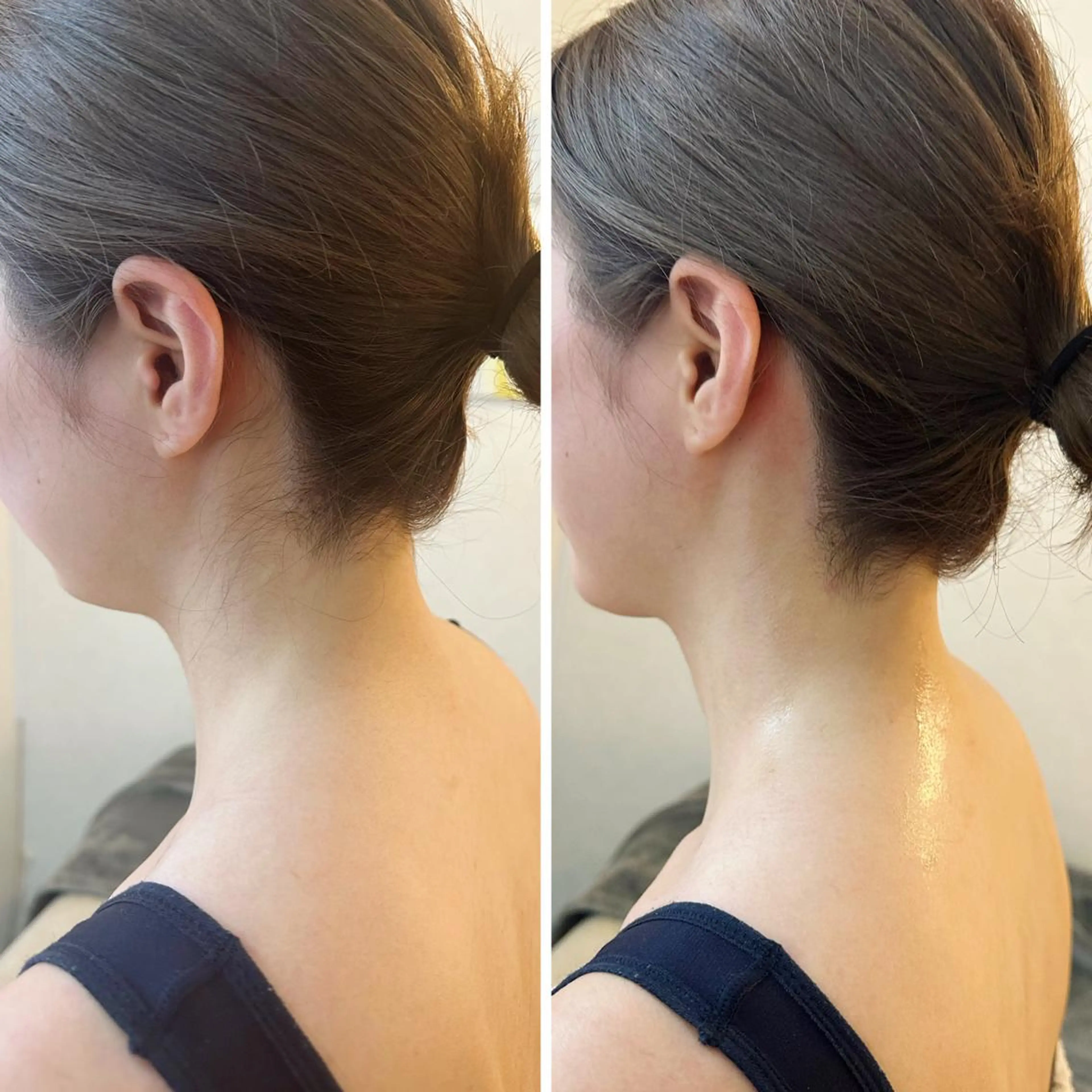 うなじ脱毛/美肌脱毛 LABELのエステ・リラクイメージ