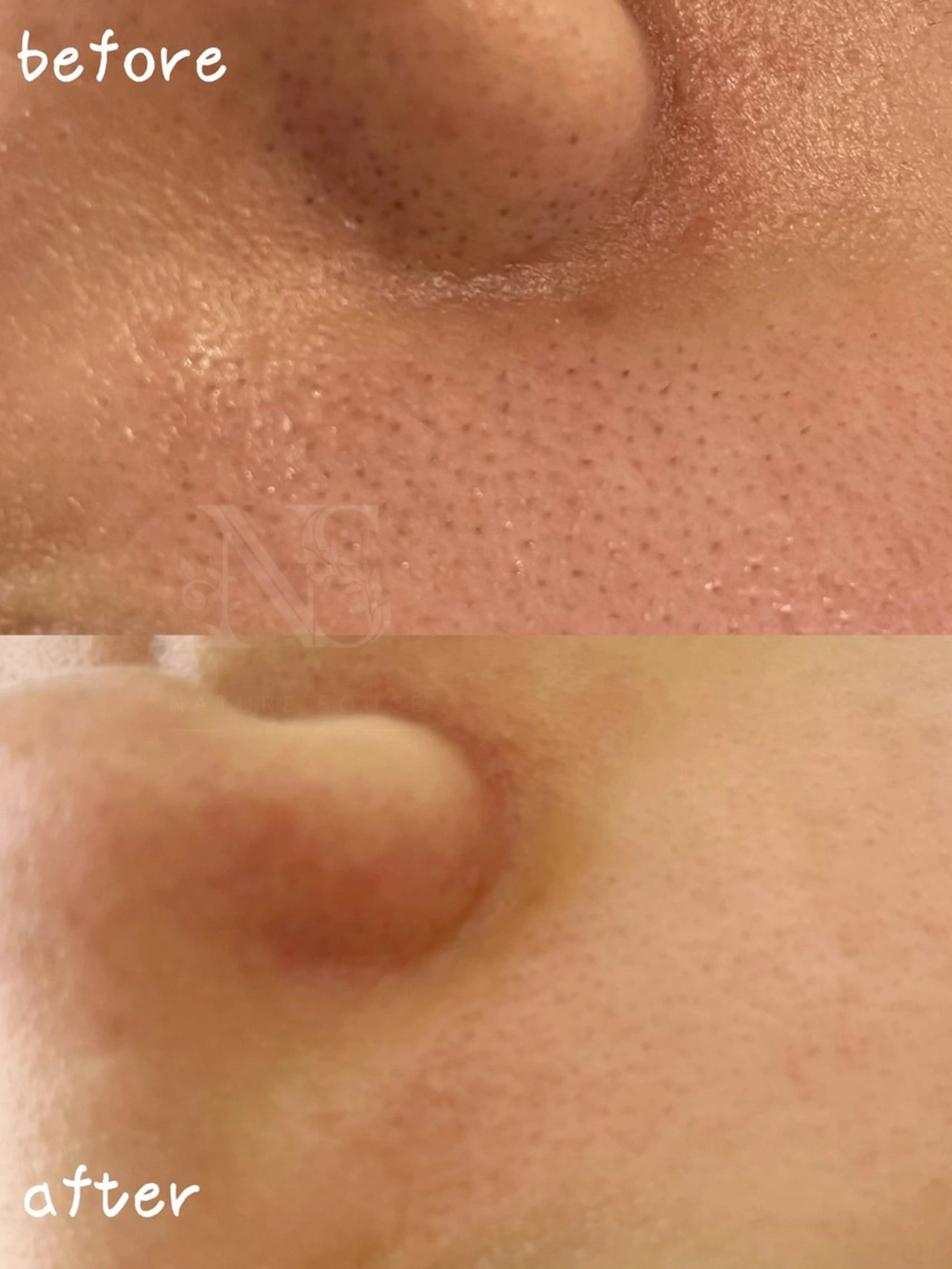 Nature Souce毛穴専門店のその他イメージ