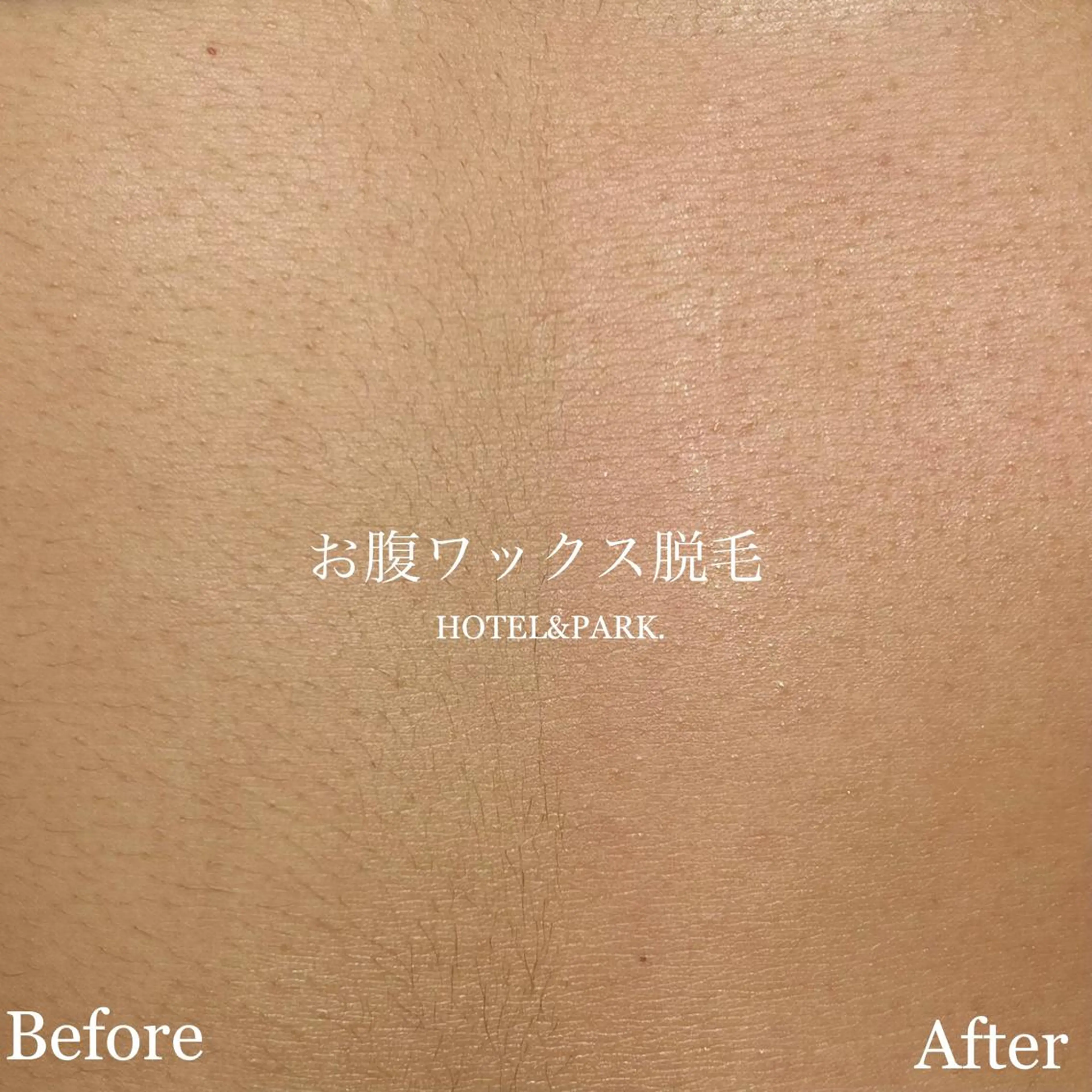 HOTEL&PARK . ワックス脱毛のエステ・リラクイメージ