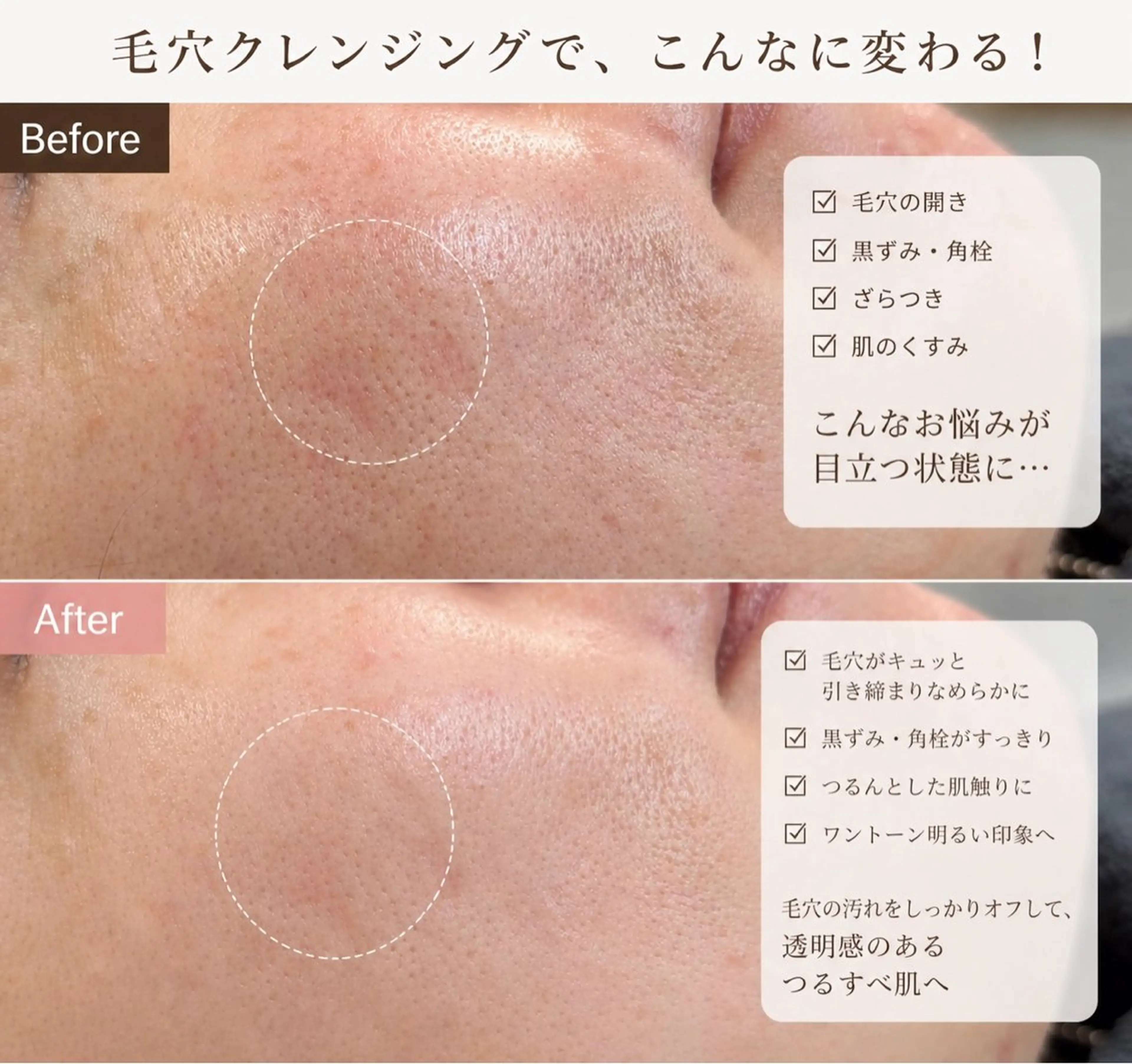 エステ Balance facialのエステ・リラクイメージ