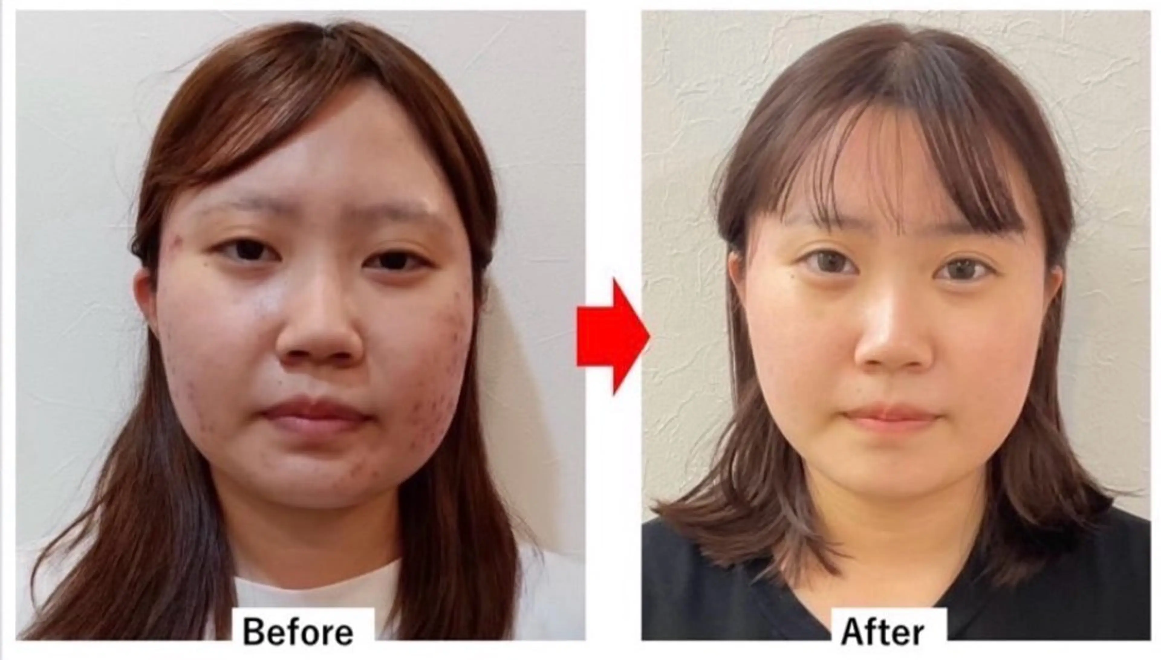 【人気No.1】頭蓋骨小顔矯正＋むくみ、たるみケア！新生活応援キャンペーン🌟メンズもOK🌿の写真