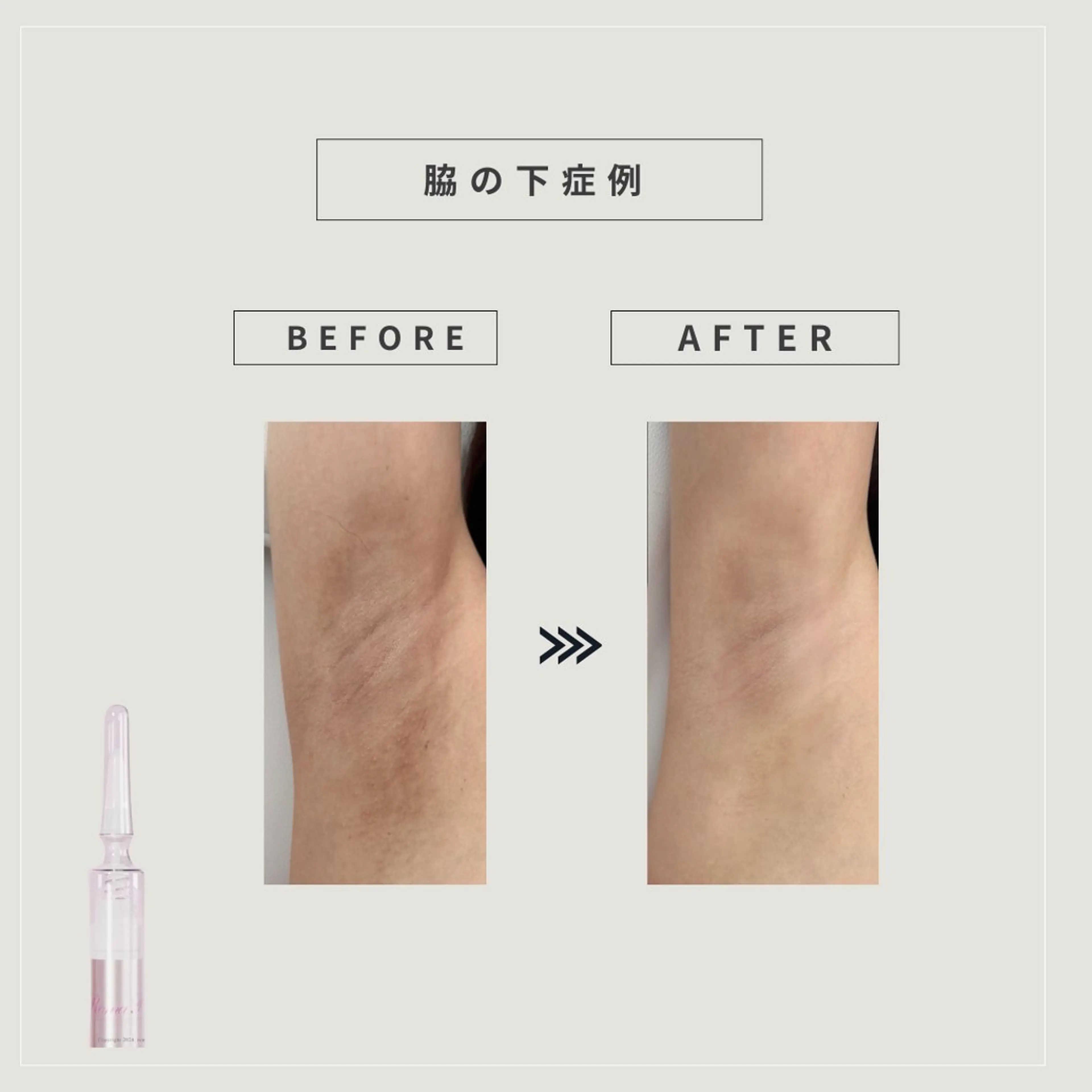 REBOND K モデル募集のマツエク・マツパデザイン