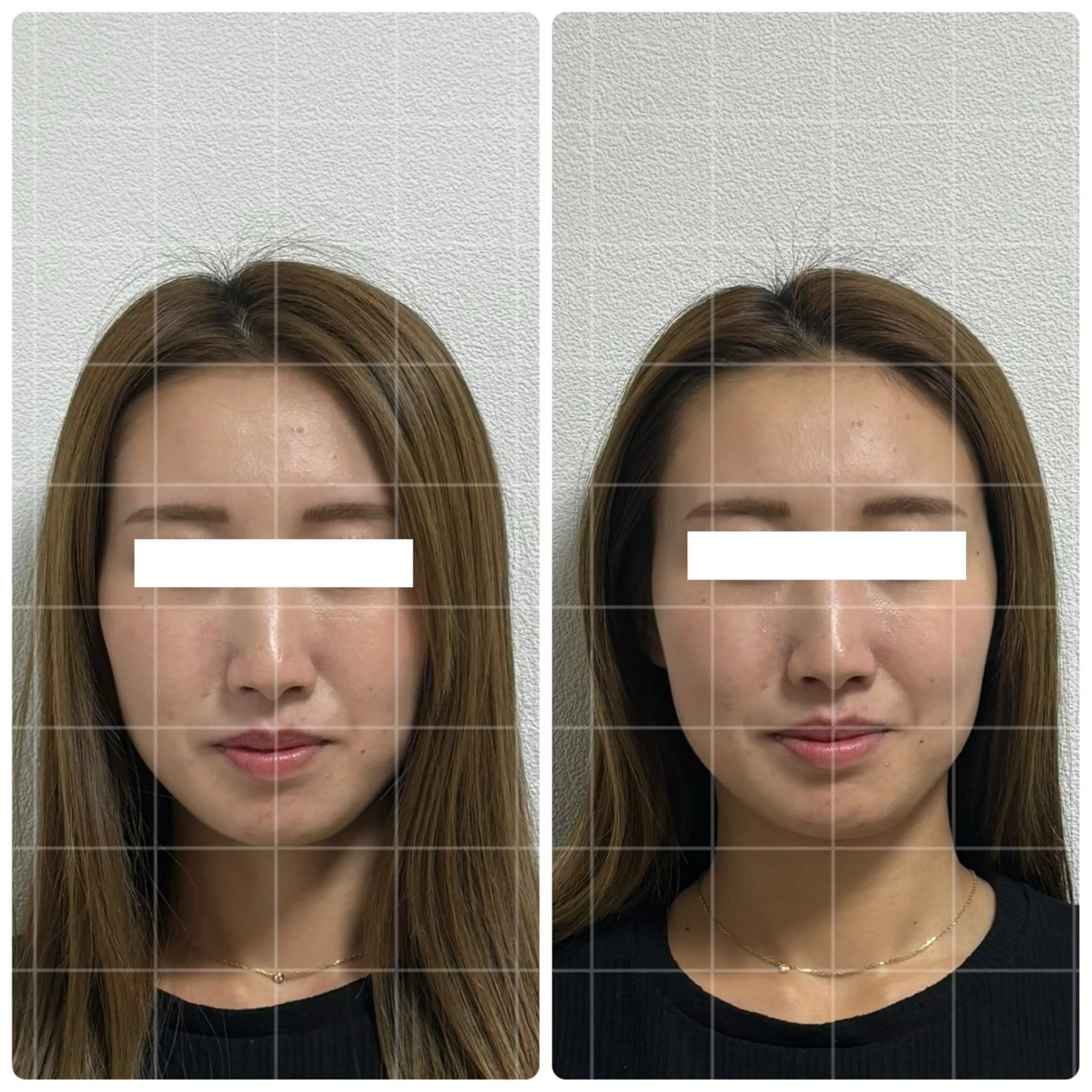 片山けいこ｜ 美人顔創りの専門家のエステ・リラクイメージ