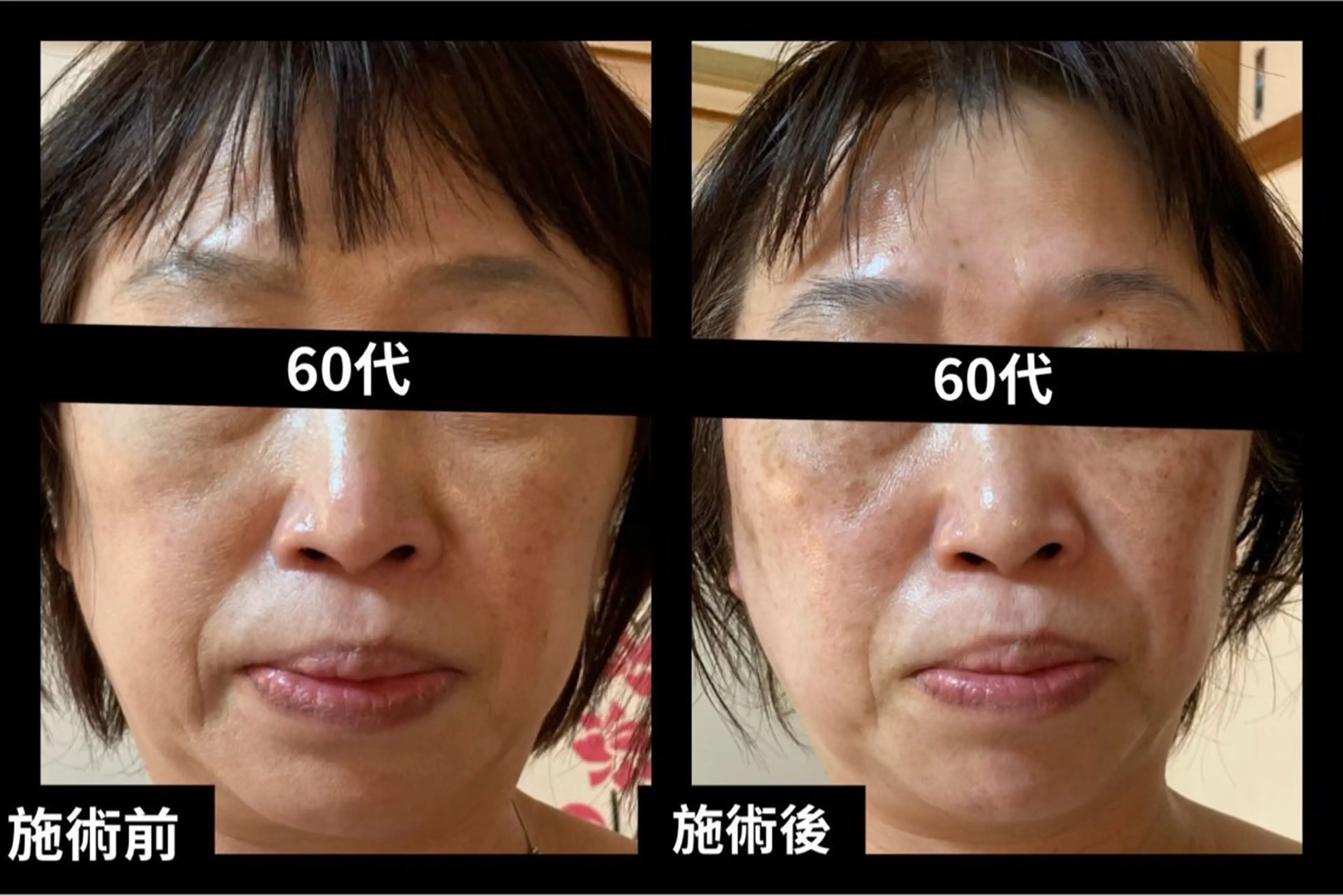 夜サロン♡ Luana🦋.*˚のエステ・リラクイメージ