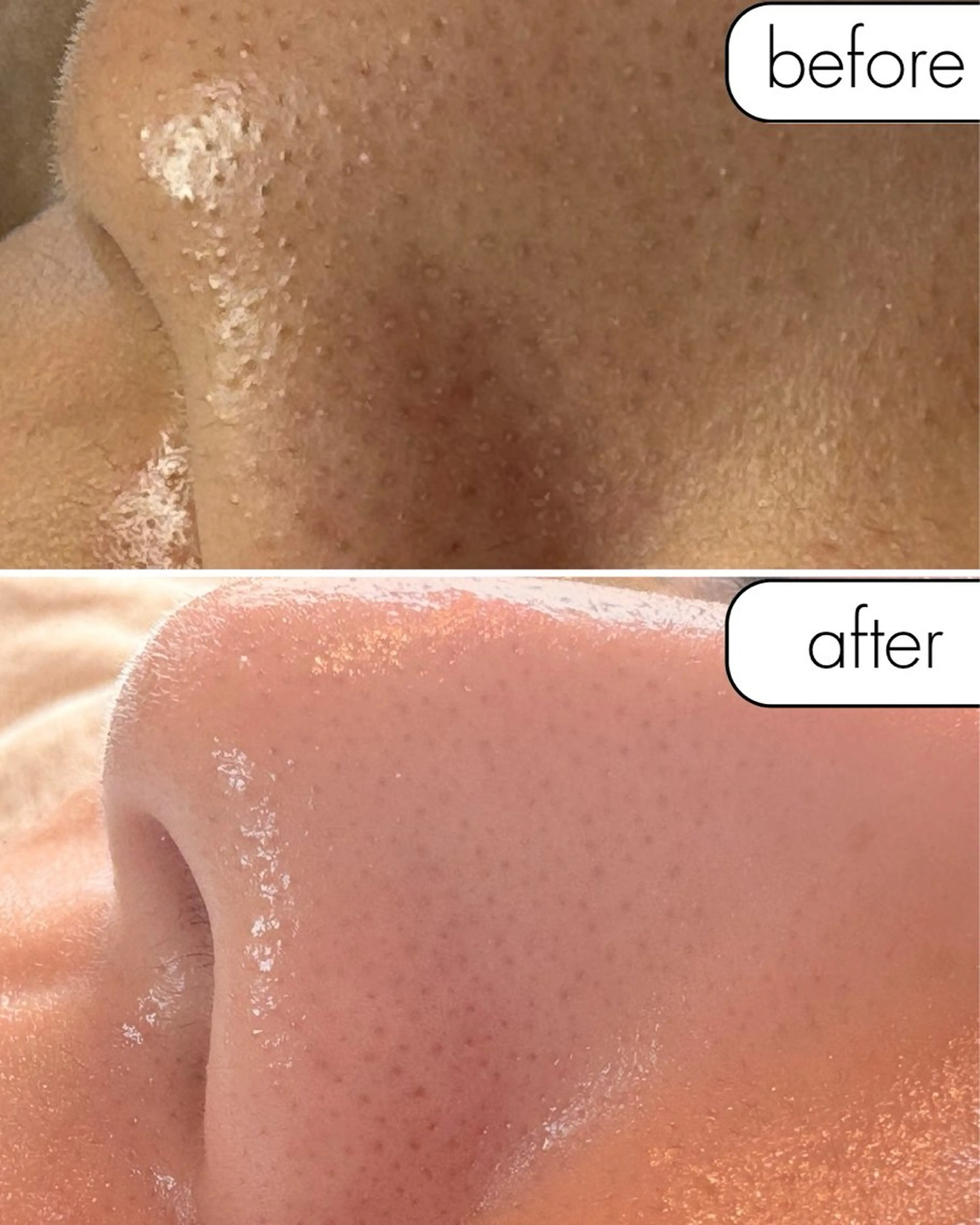 脱毛 蝶式糸除毛専門salon aco所属・糸除毛専門salon acoのエステ・リラクイメージ