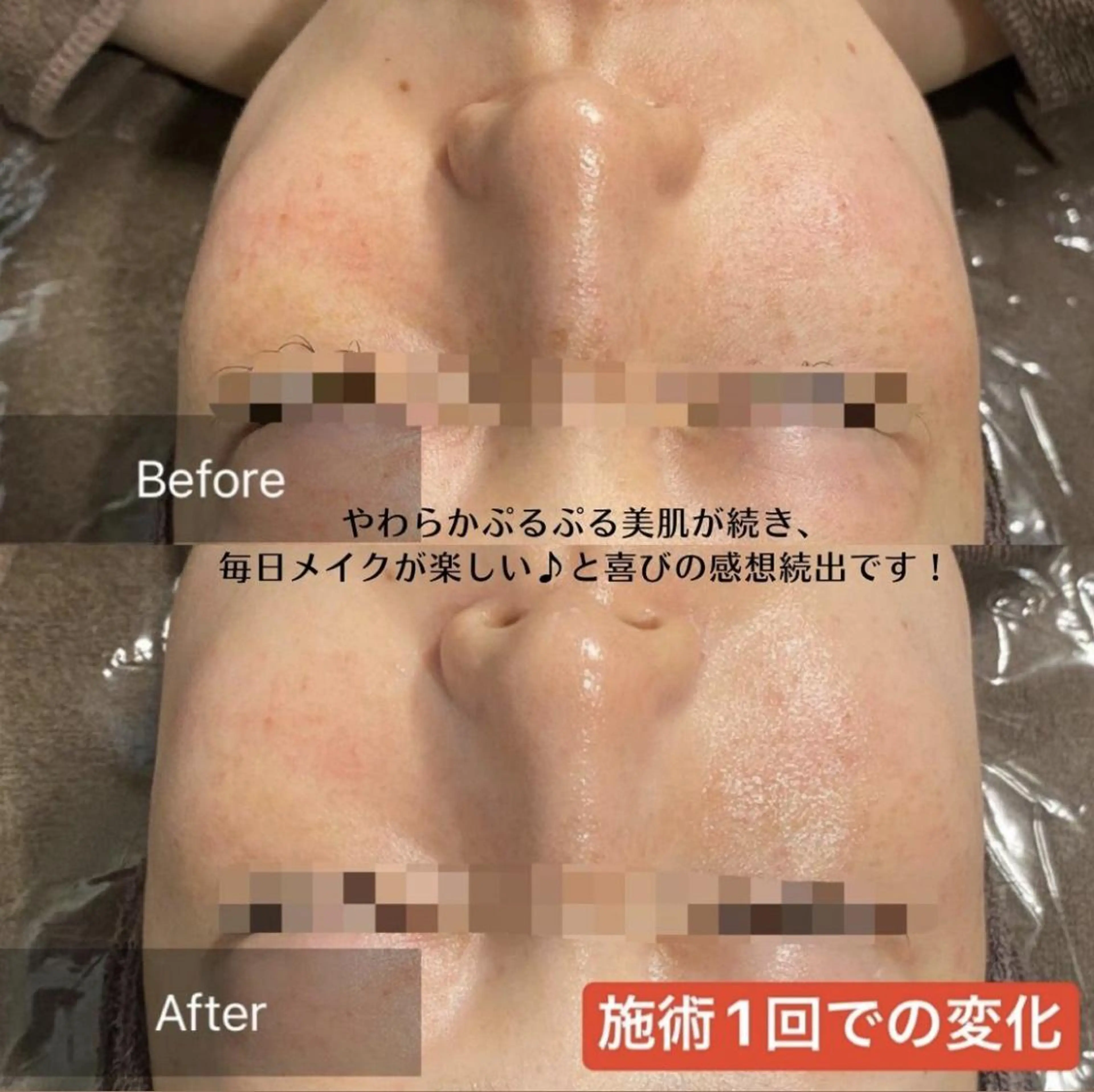 ビューティースリム reborn吉祥寺店のエステ・リラクイメージ