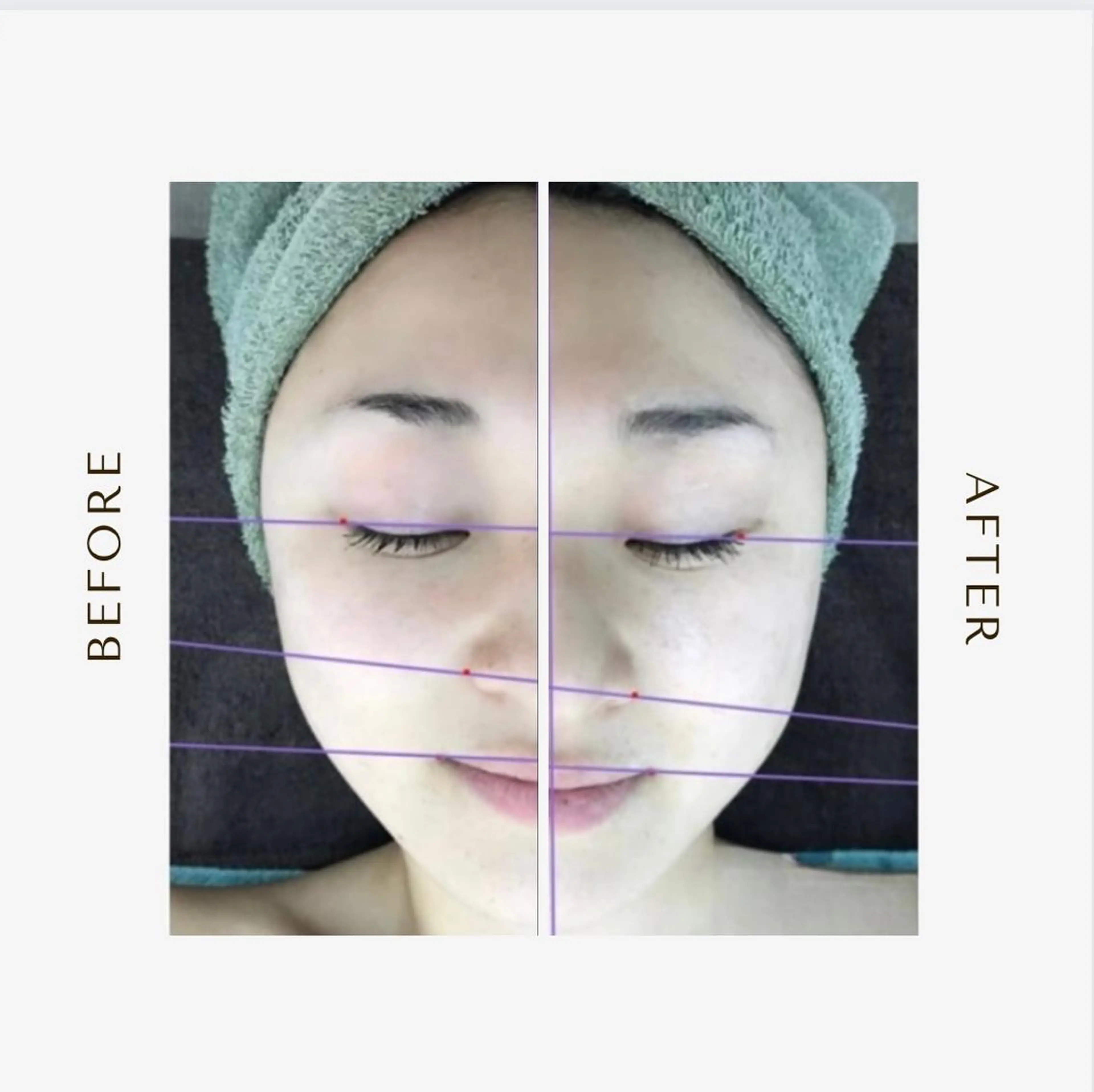 エステ ピーリング＆脱毛 maoのエステ・リラクイメージ