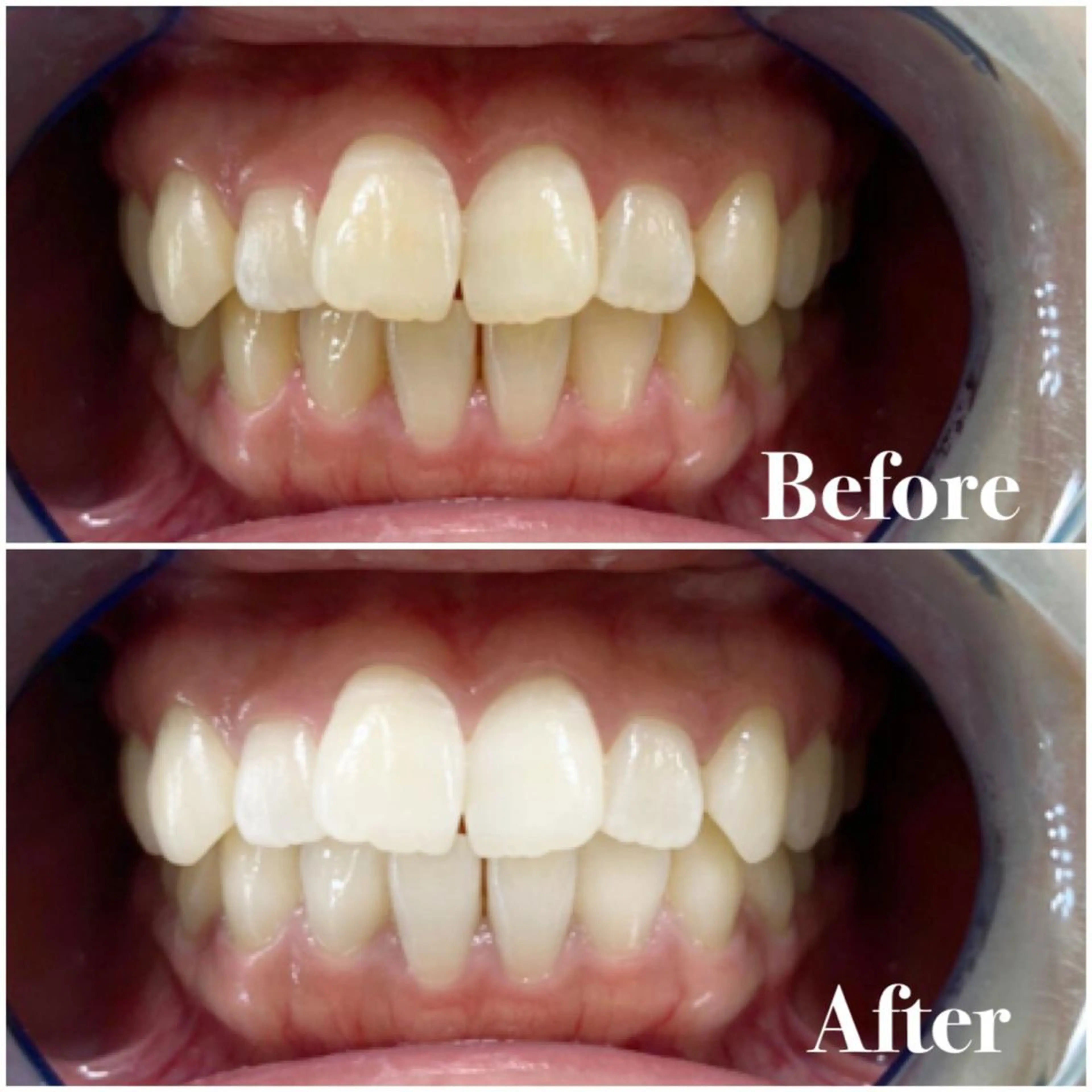 ロング カラー パーマ ヘアアレンジ メンズ キッズ ネイル マツエク・マツパ ライトビューティー 錦糸町店のエステ・リラクイメージ