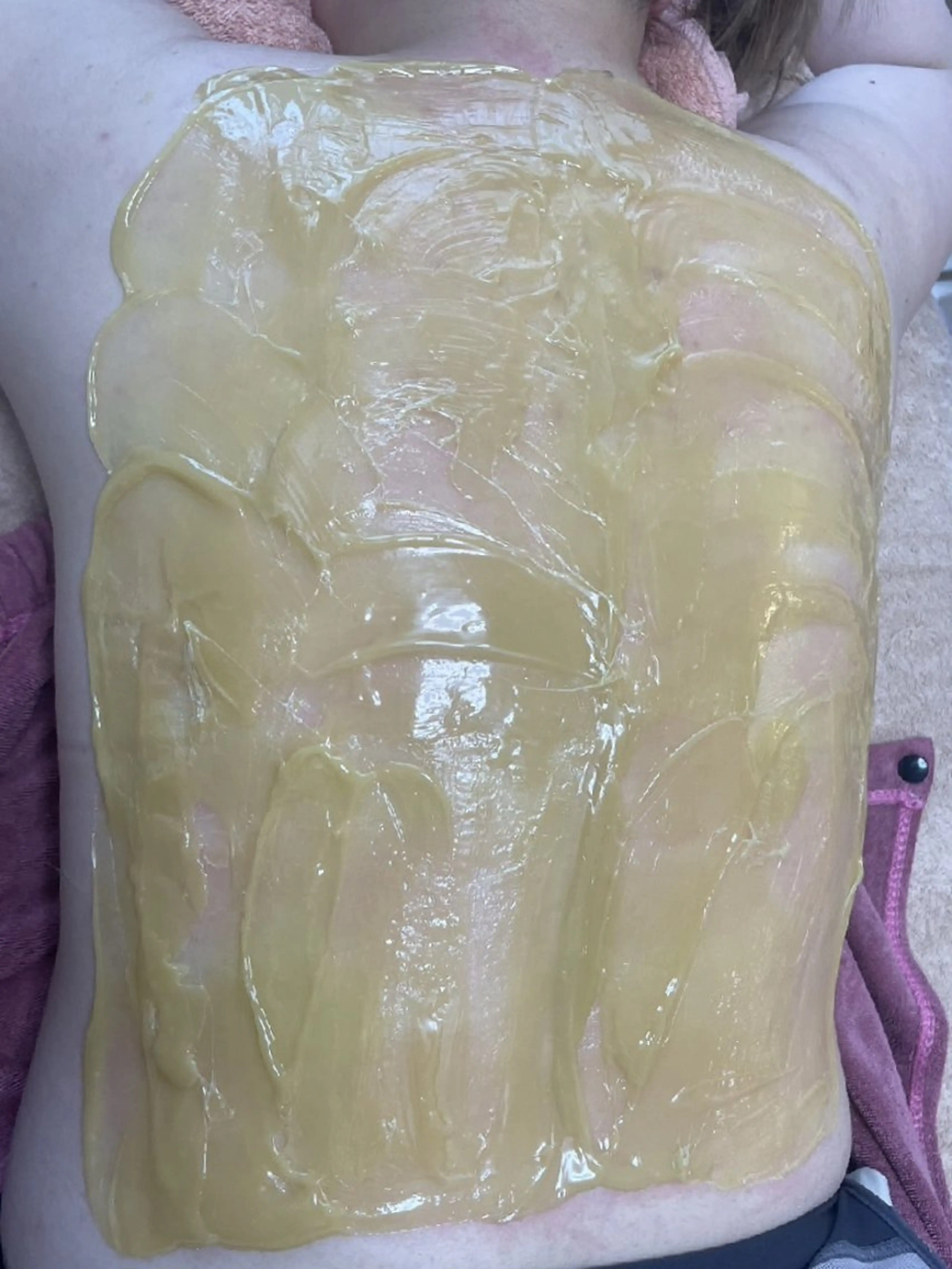 エステ 結果が出るスキンケア 肌質改善/まつパのエステ・リラクイメージ