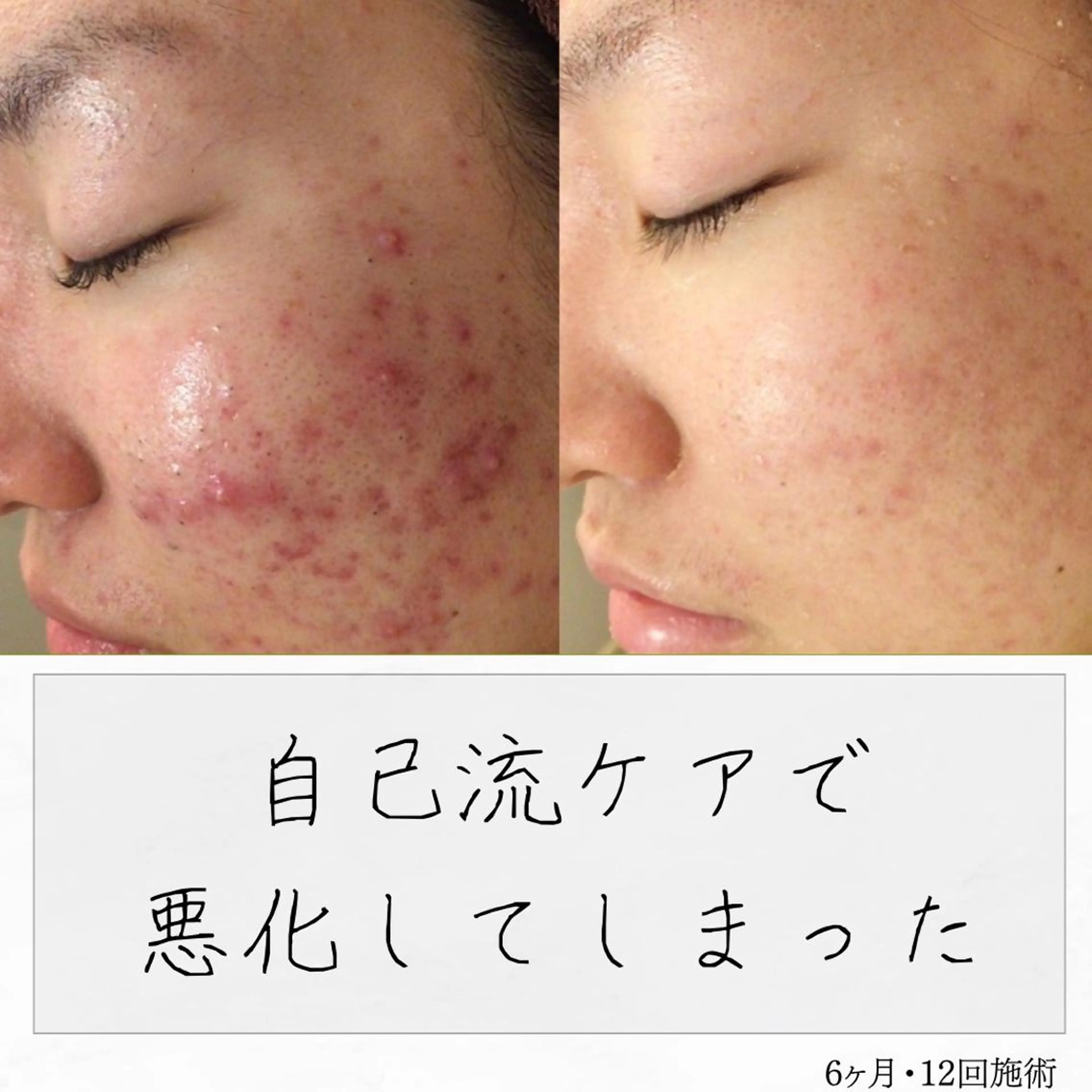 ニキビ経験者が施術 する専門サロン🌻のエステ・リラクイメージ