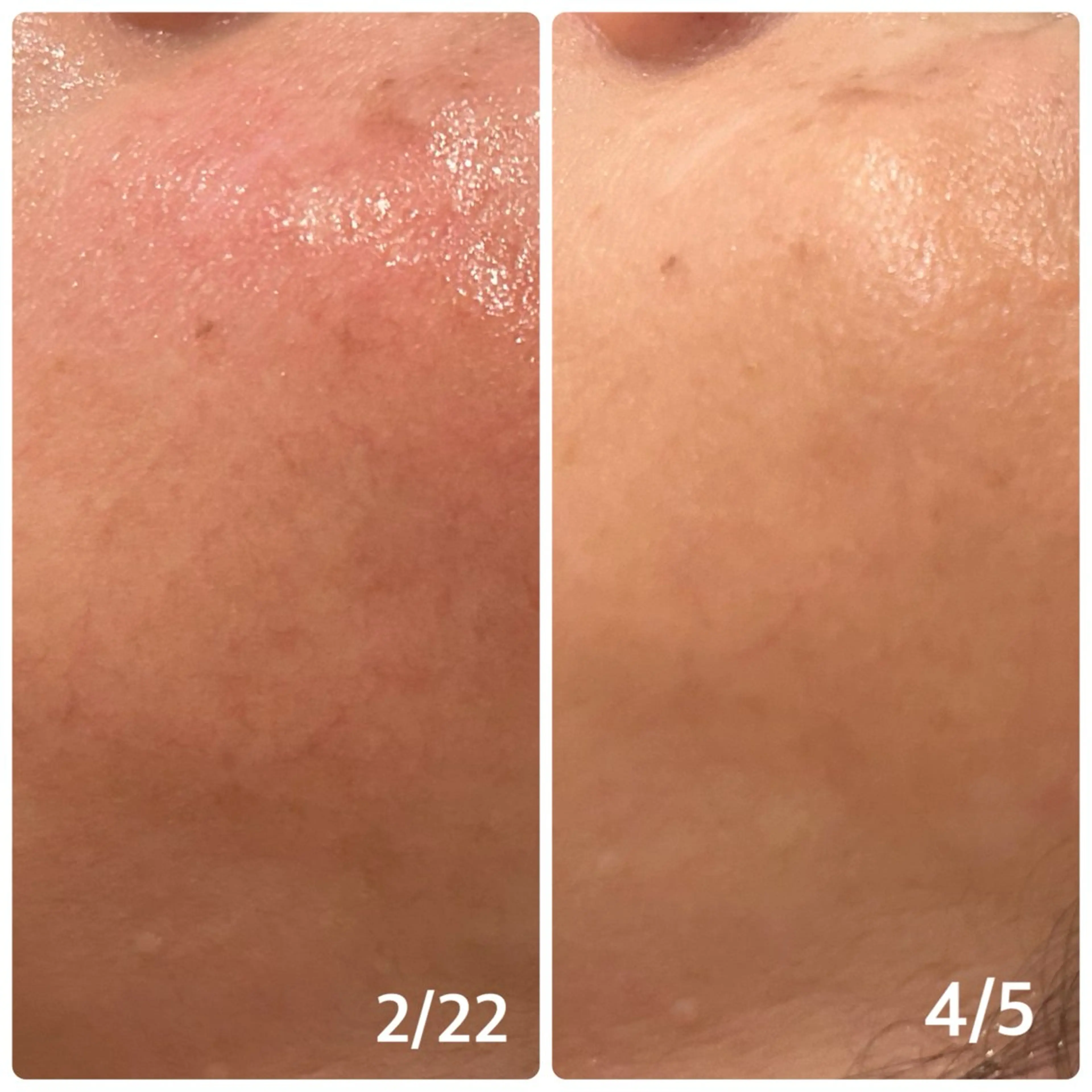 エステ リラク メナード片町 やまもと みくのエステ・リラクイメージ