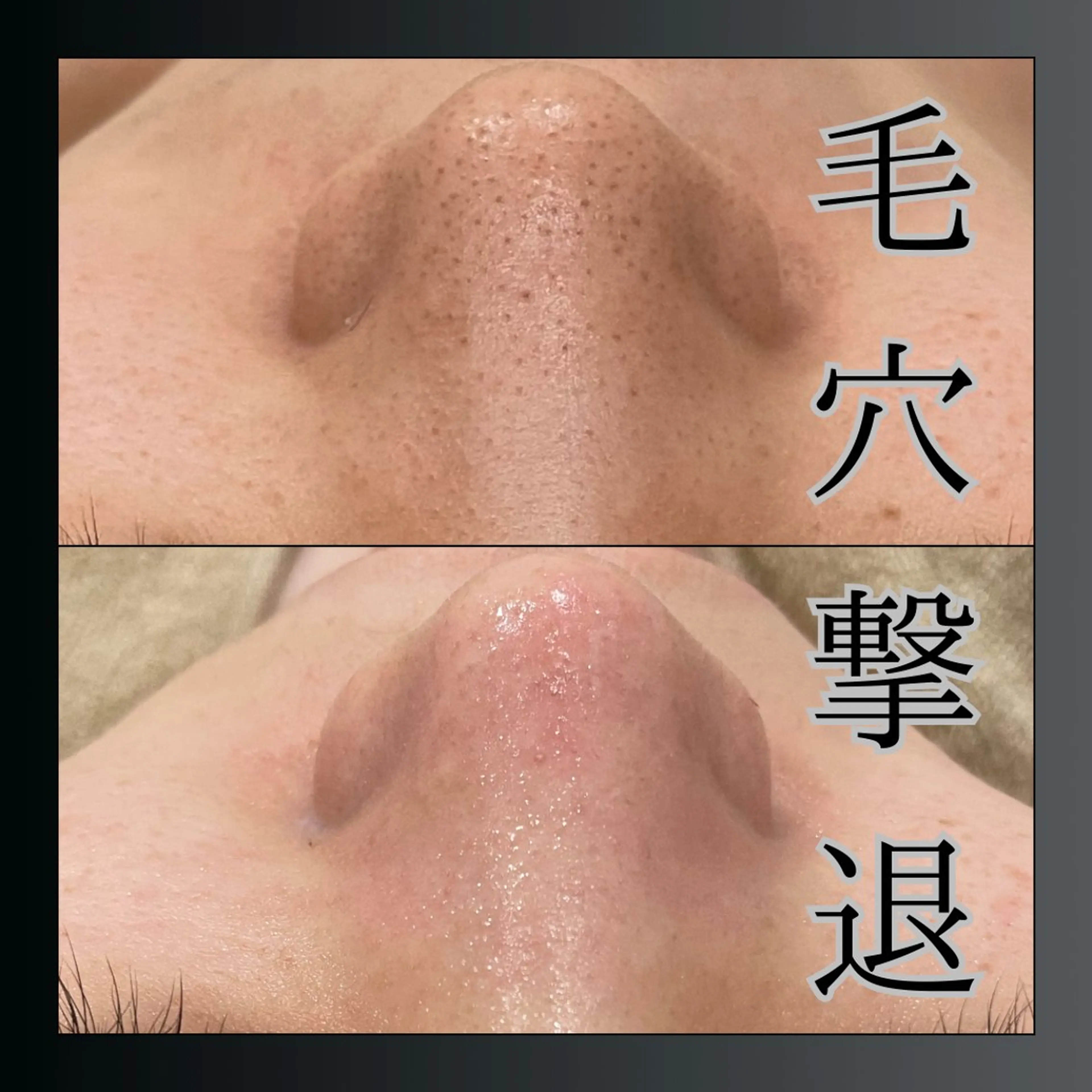 エステ LiZA エステティックサロンのエステ・リラクイメージ