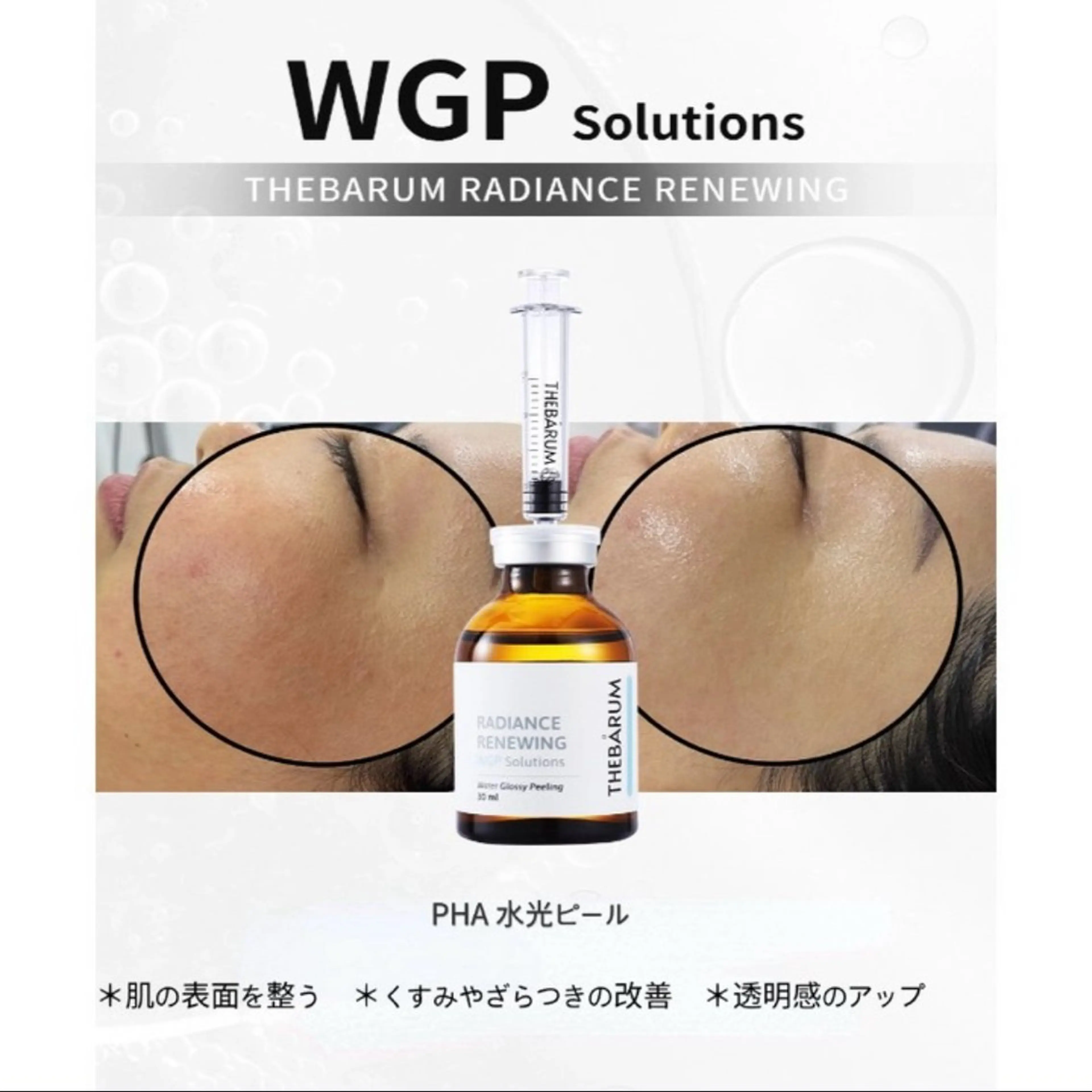 ハーブピーリング肌 管理🌿Ante関内のエステ・リラクイメージ