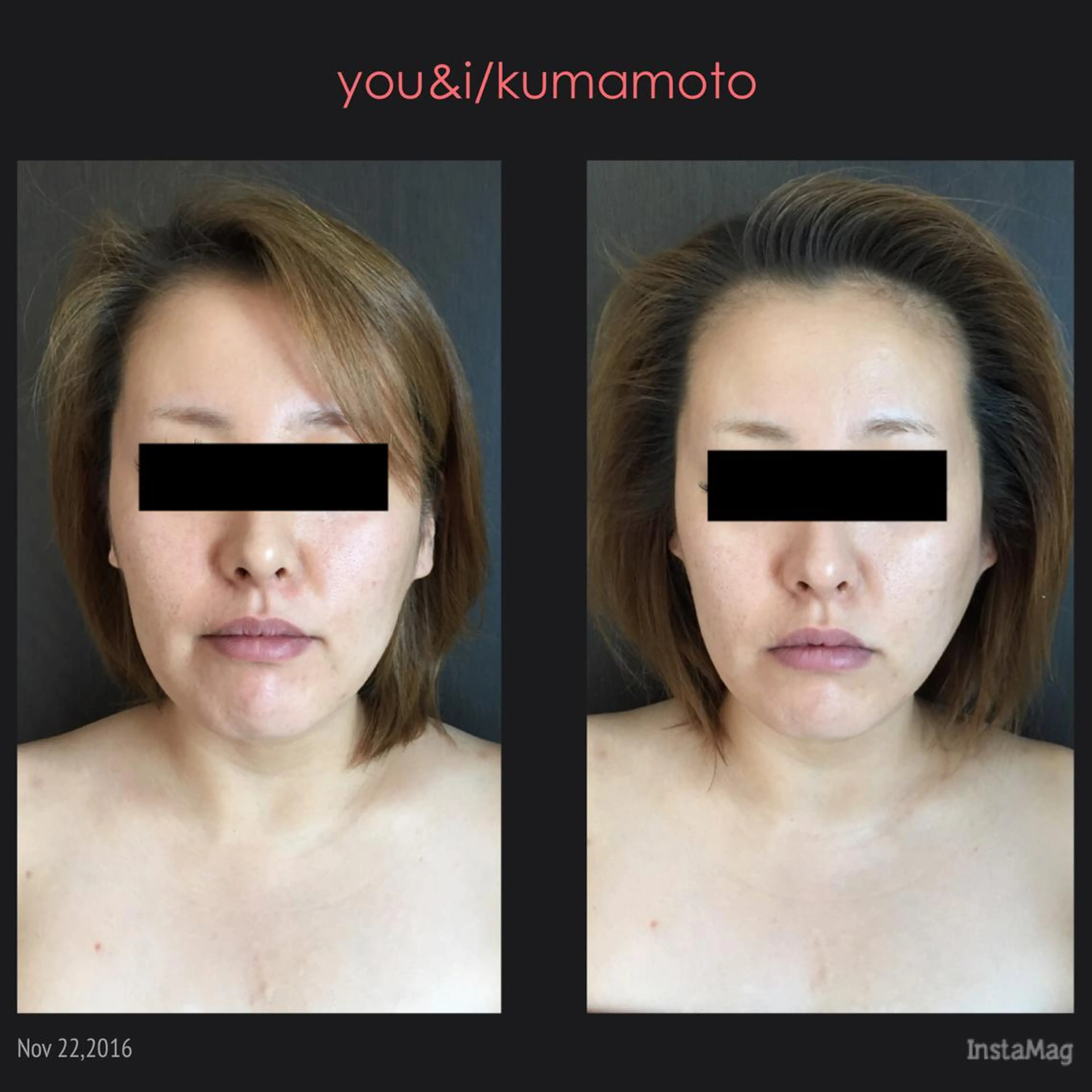 キッズ マツエク・マツパ Nomura Suuのエステ・リラクイメージ