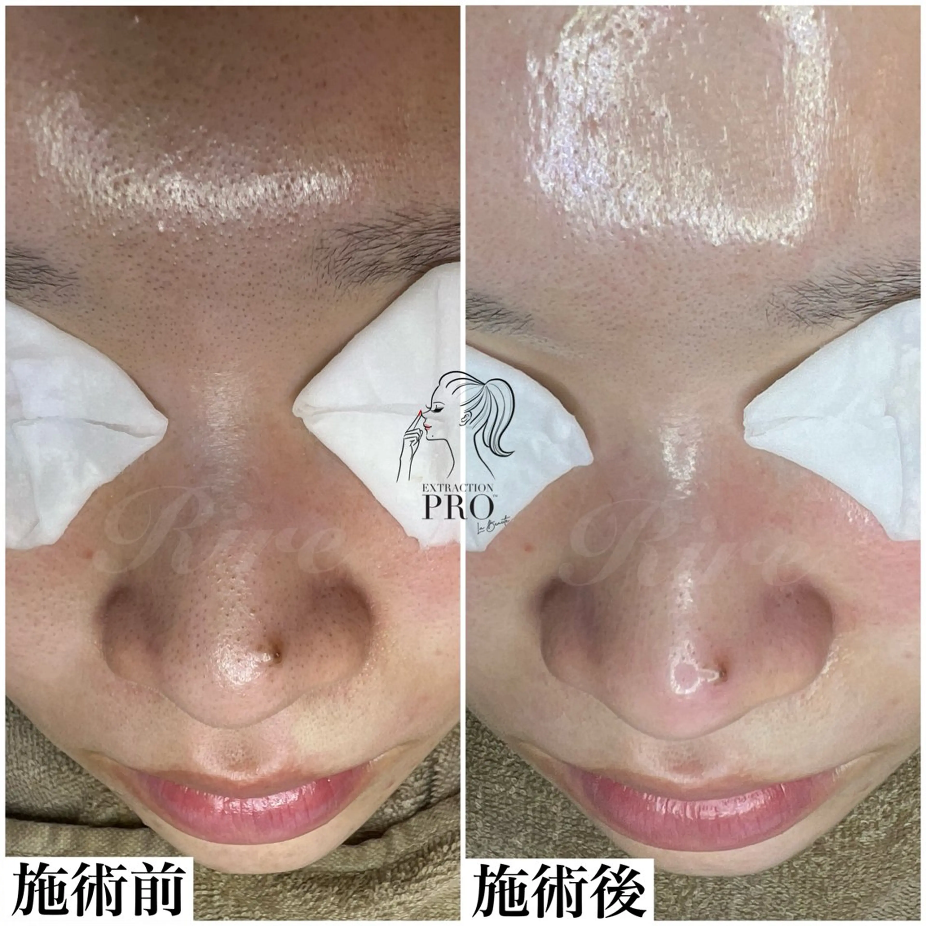 エステ 隅田 都布子のマツエク・マツパデザイン