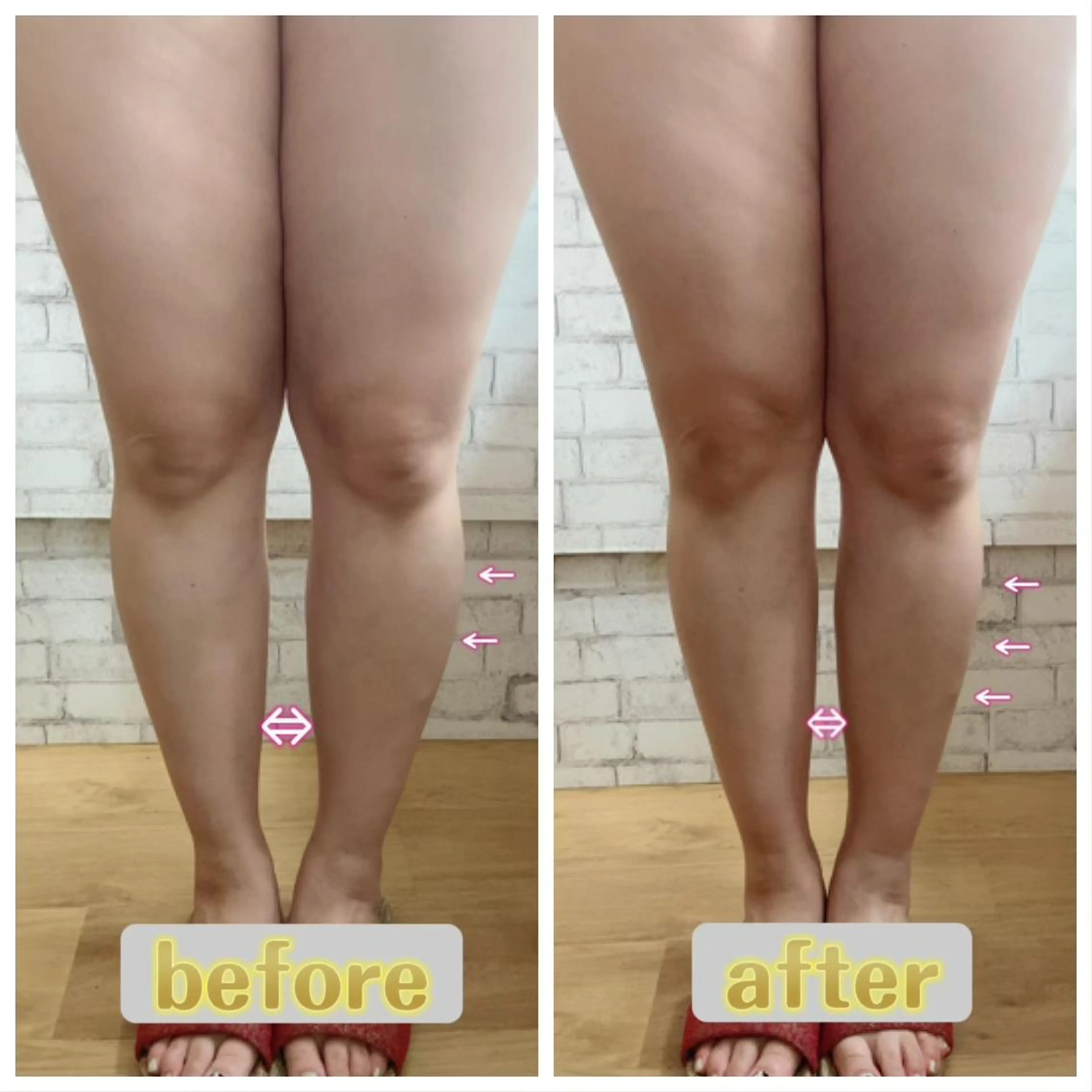 【小顔矯正】 salonaceのエステ・リラクイメージ