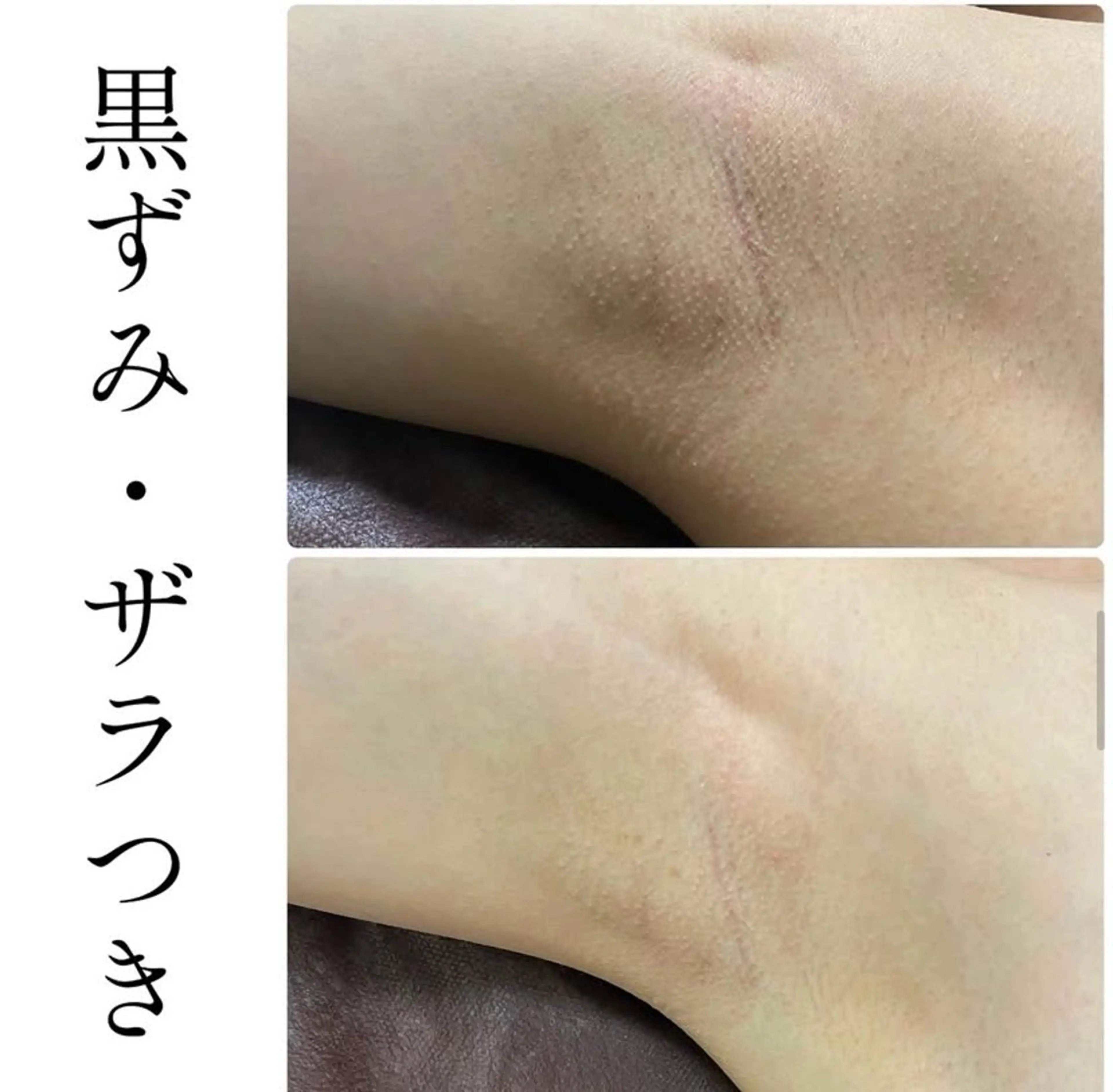 エステ ハーブピーリング専門 BIOPLUS＋川崎のエステ・リラクイメージ