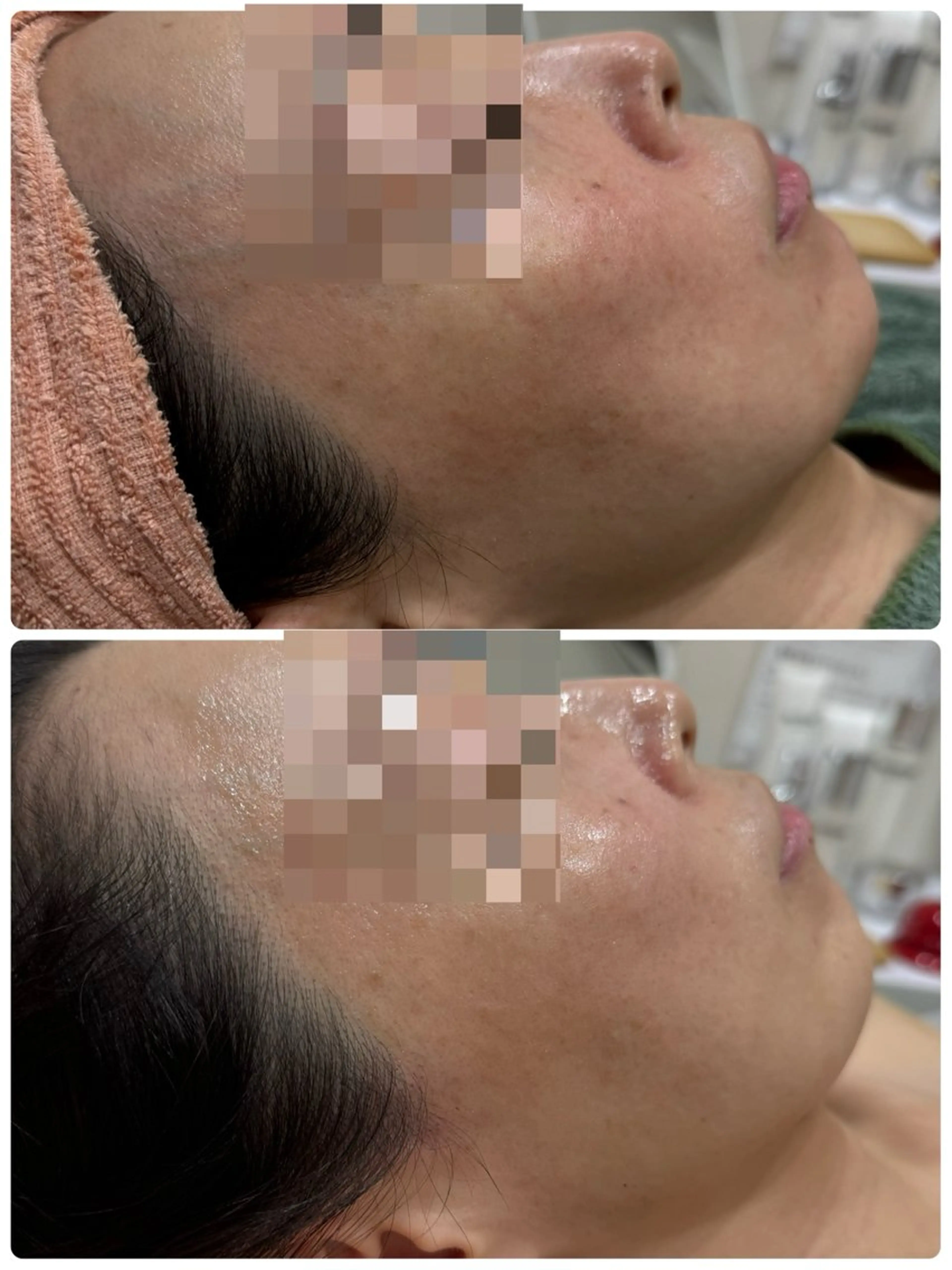 エステ 脱毛&フェイシャル 専門店muro.のエステ・リラクイメージ