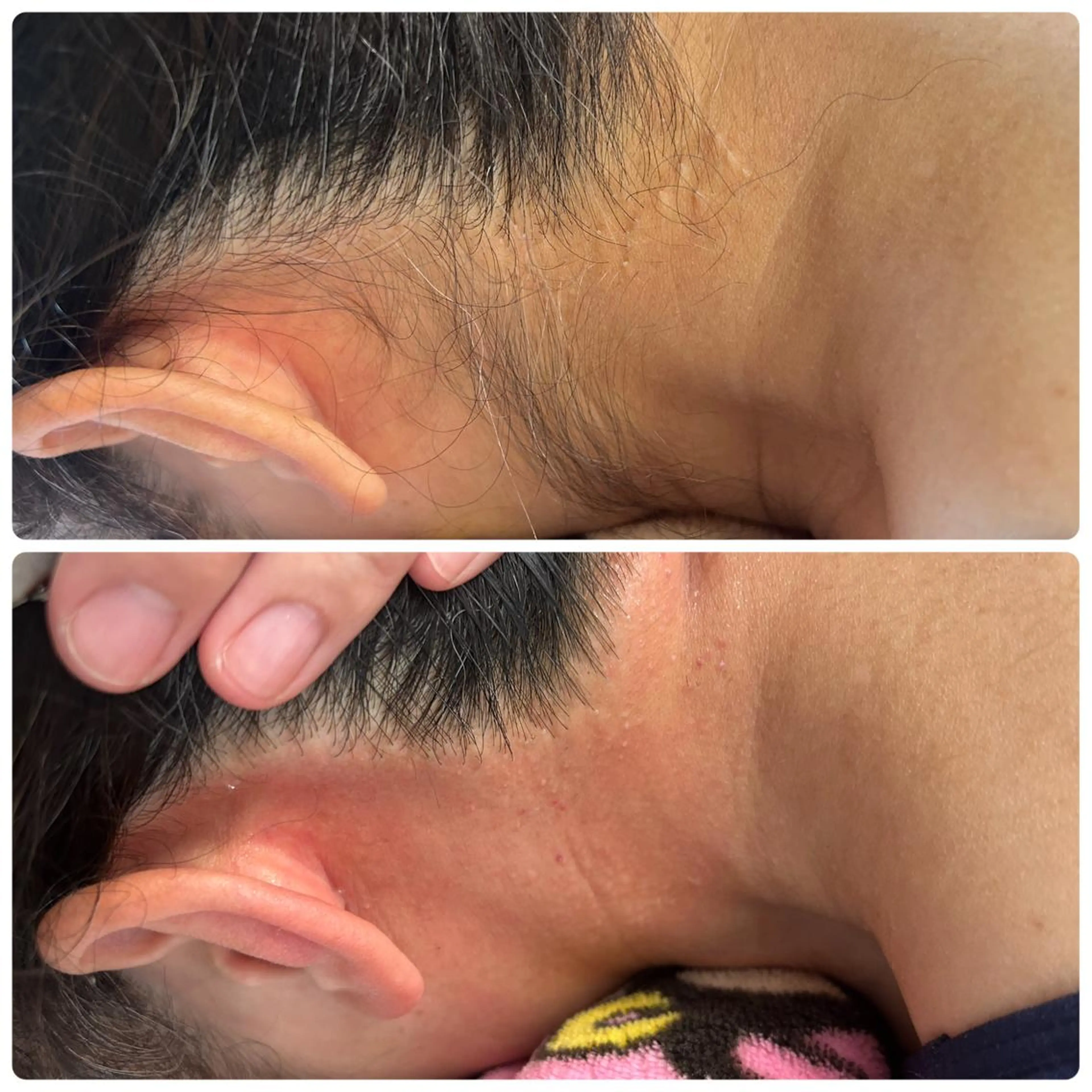 メンズ キッズ 脱毛 STELLAR. 谷岡恵里香のエステ・リラクイメージ