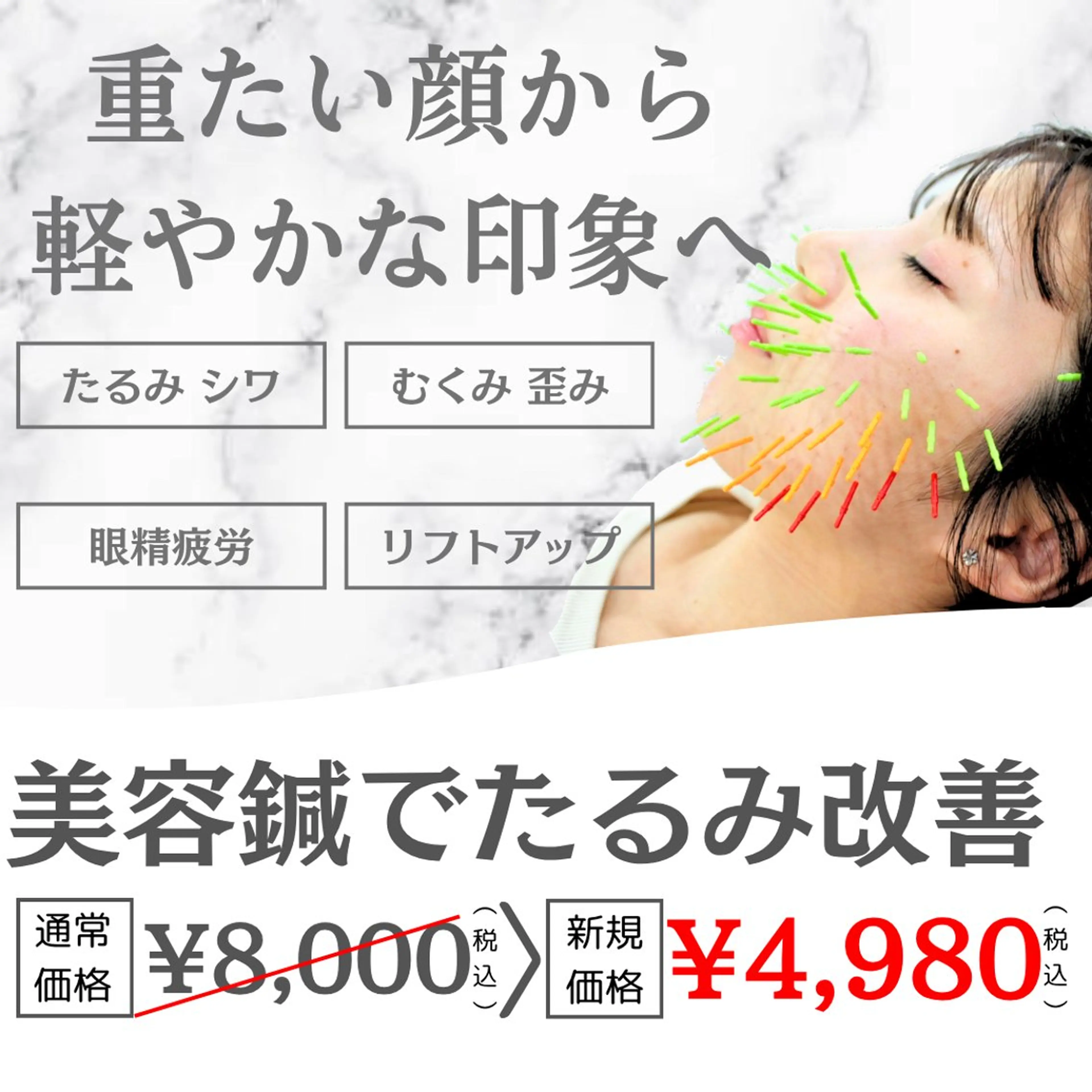 【人気No.1メニュー】美容鍼(たるみ 小顔 ほうれい線 眼精疲労 顔のむくみ リフトアップ たるみ)(60分)の写真