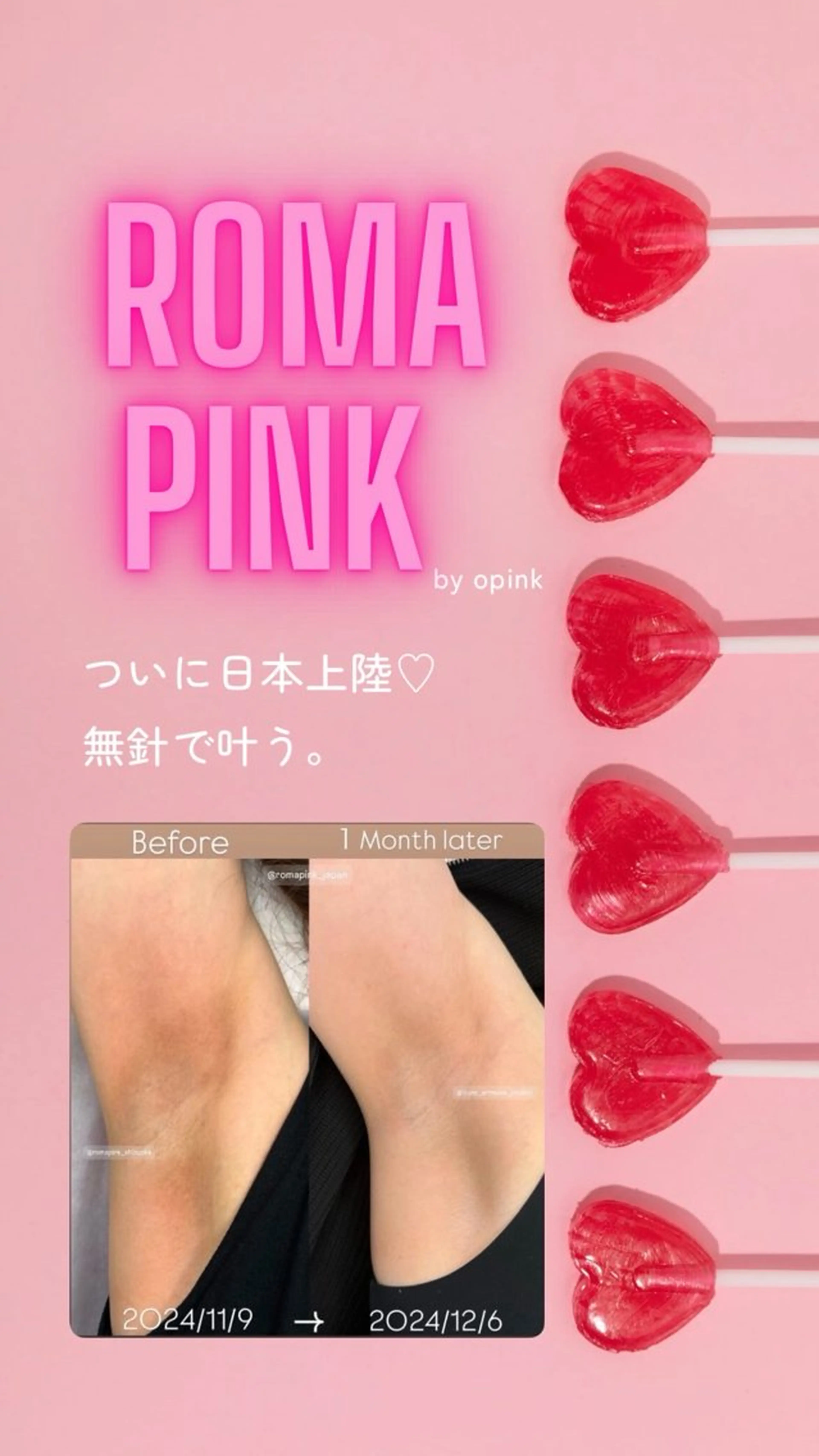 Monreve所属・美人スイッチdiet スーパージェクションのその他イメージ