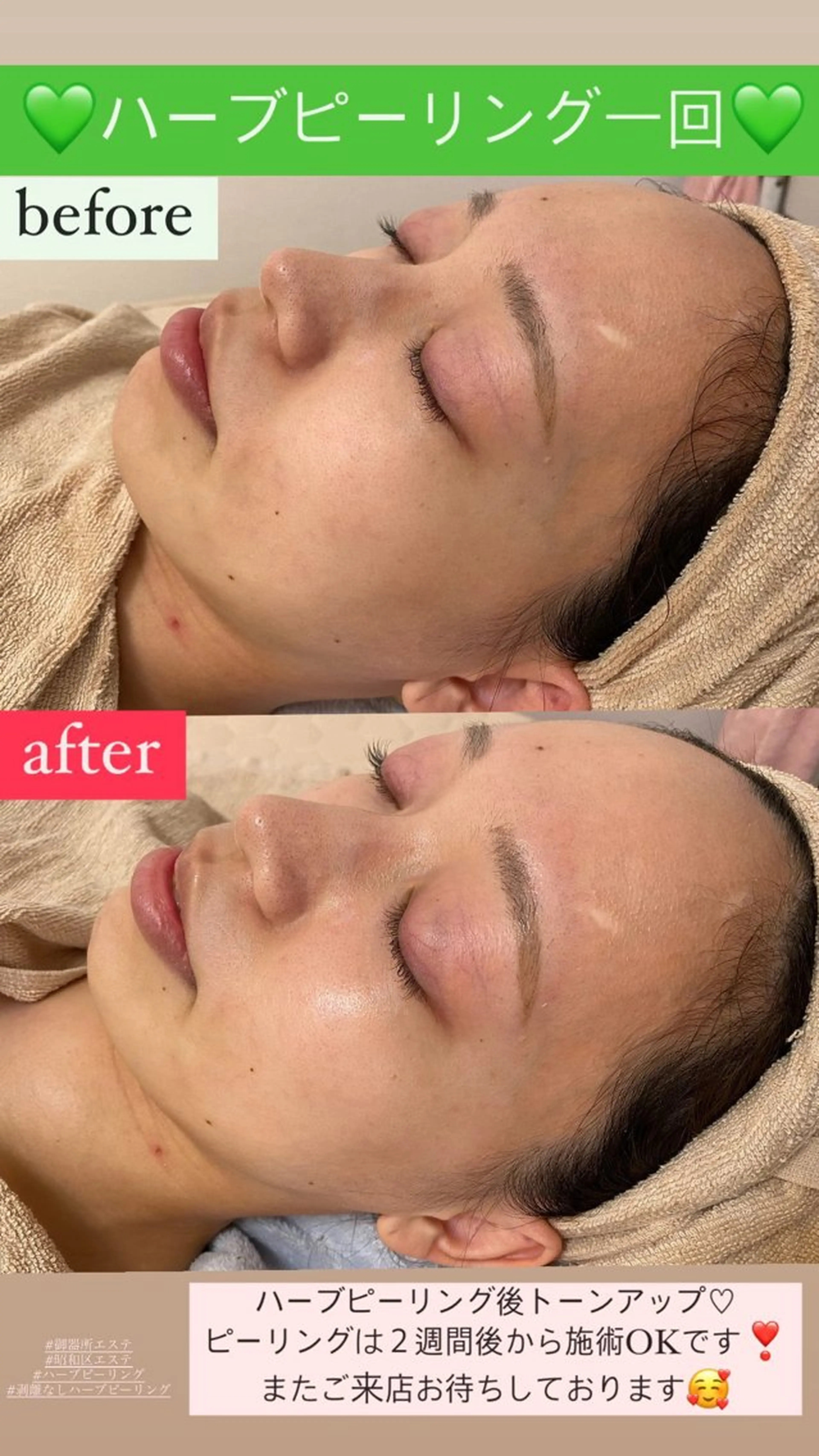 エステ Salon de Lino 御器所のエステ・リラクイメージ