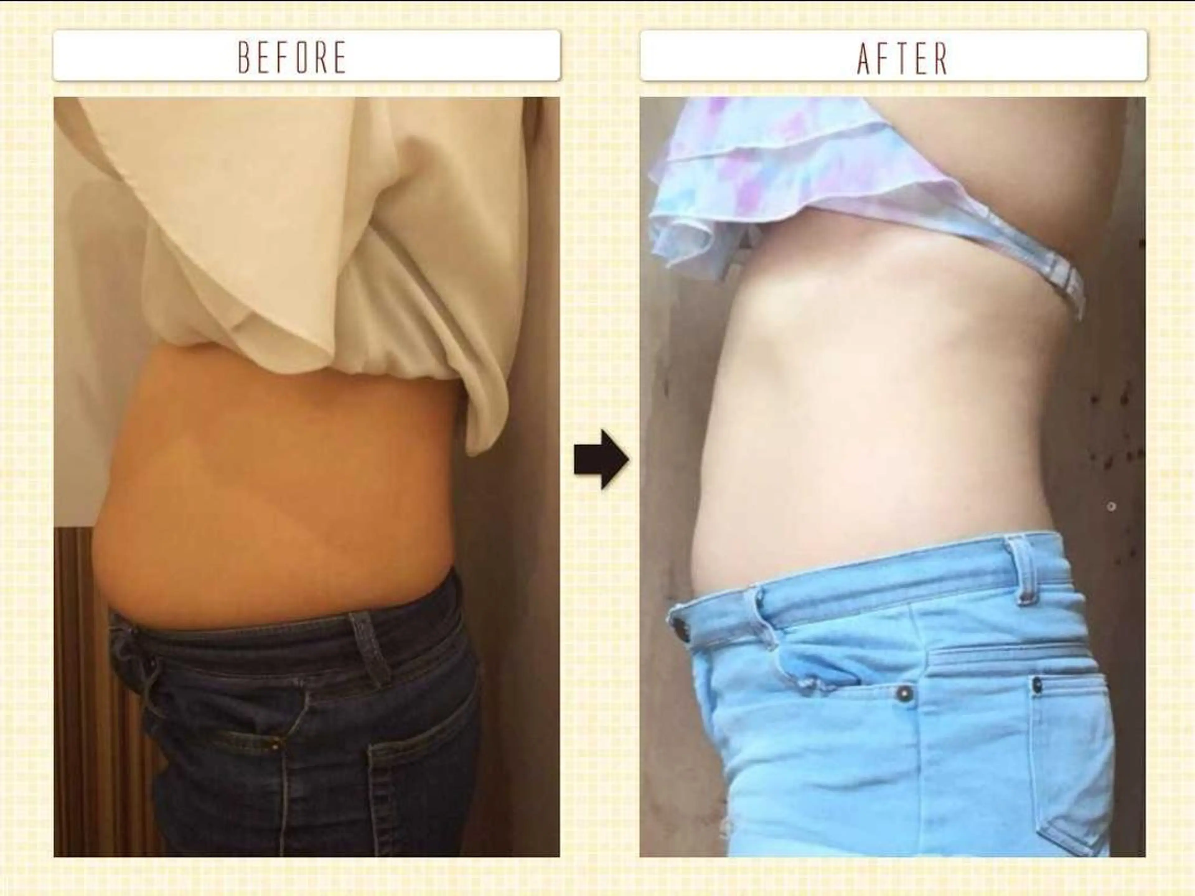 お顔のむくみたるみ 専門☆美容鍼小顔矯正のエステ・リラクイメージ