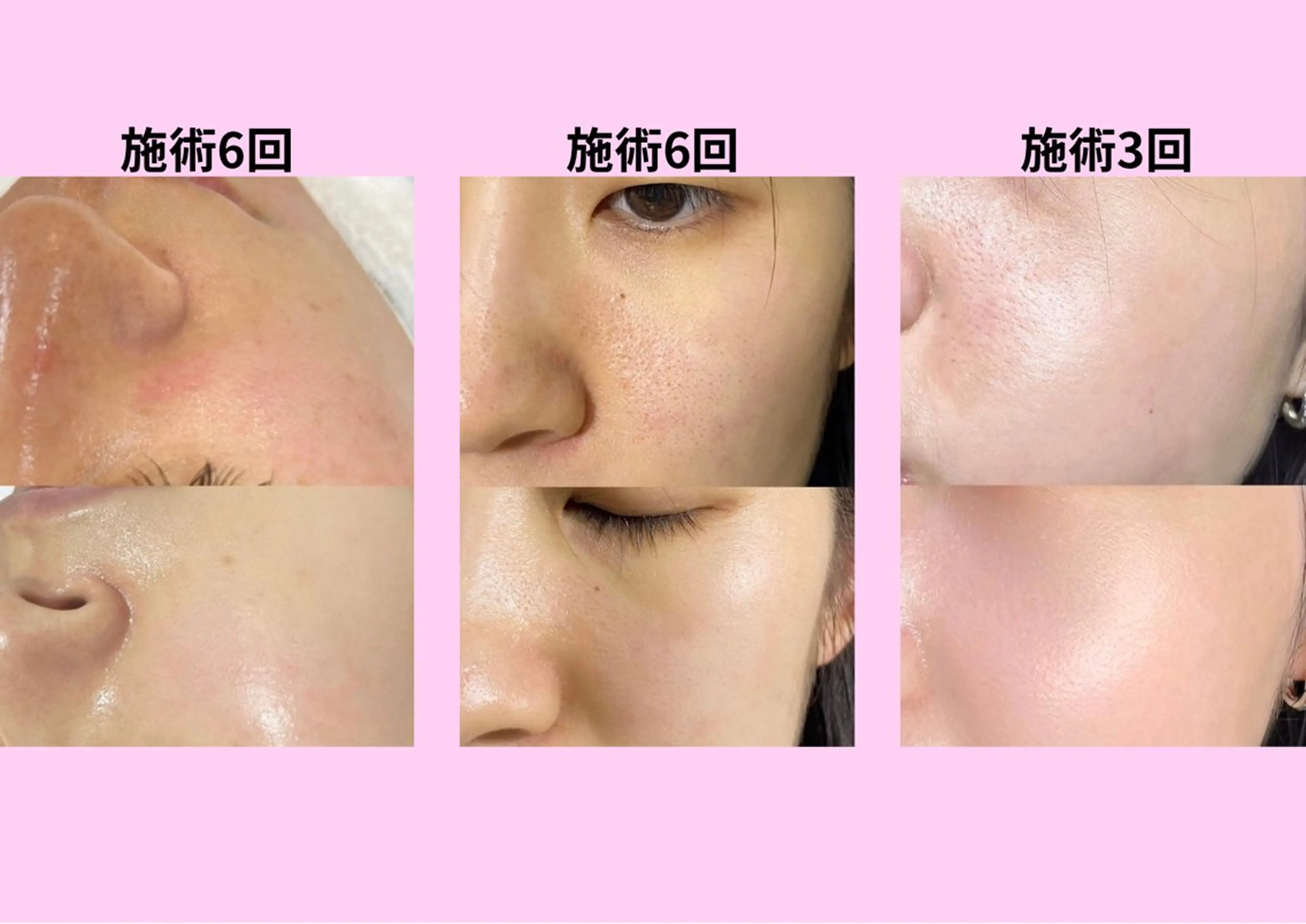 ネイル エステ リラク 愛維美水光美肌専門店所属・愛維美水光美肌専門店 メンズレディースokのエステ・リラクイメージ