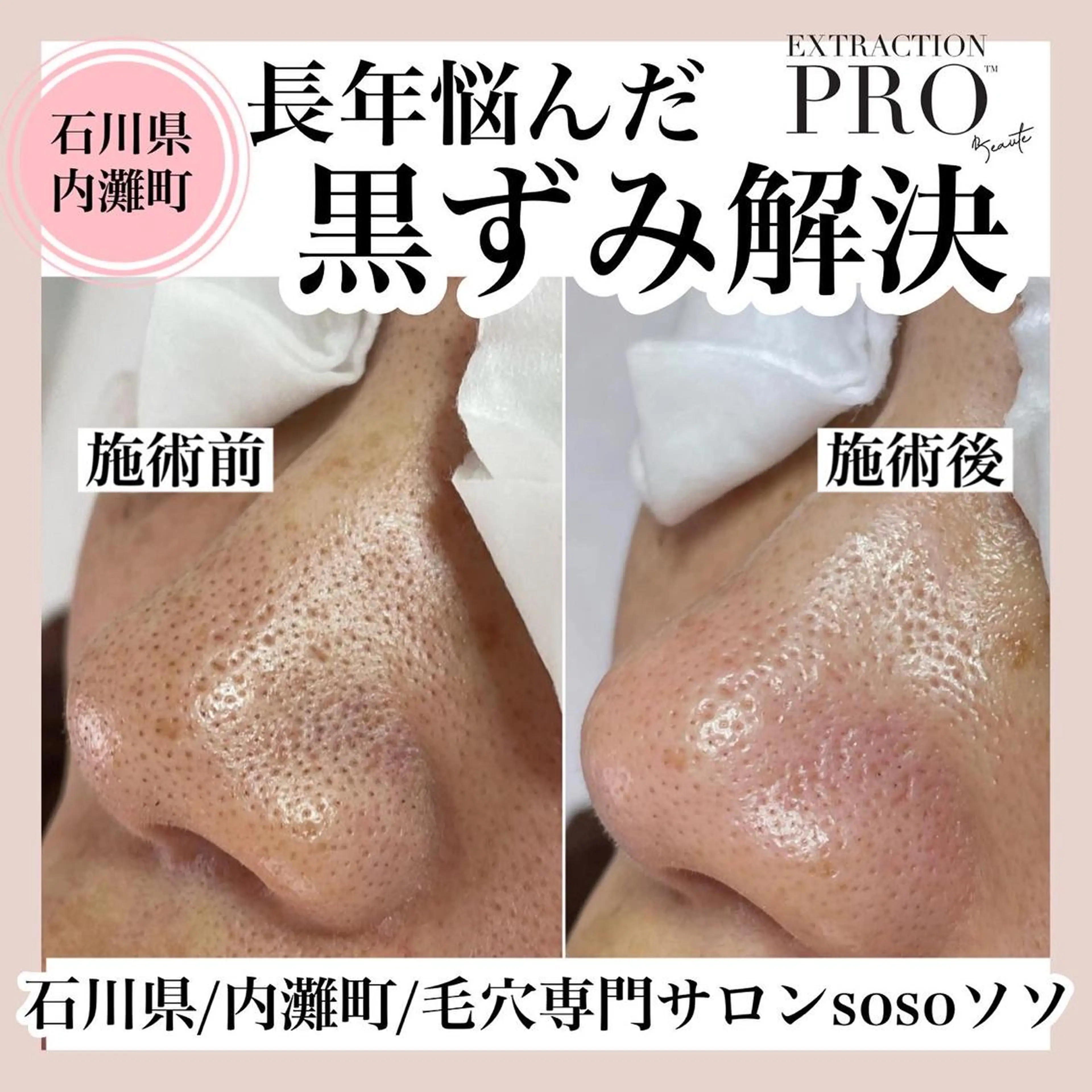 salon soso(ソソ)のエステ・リラクイメージ