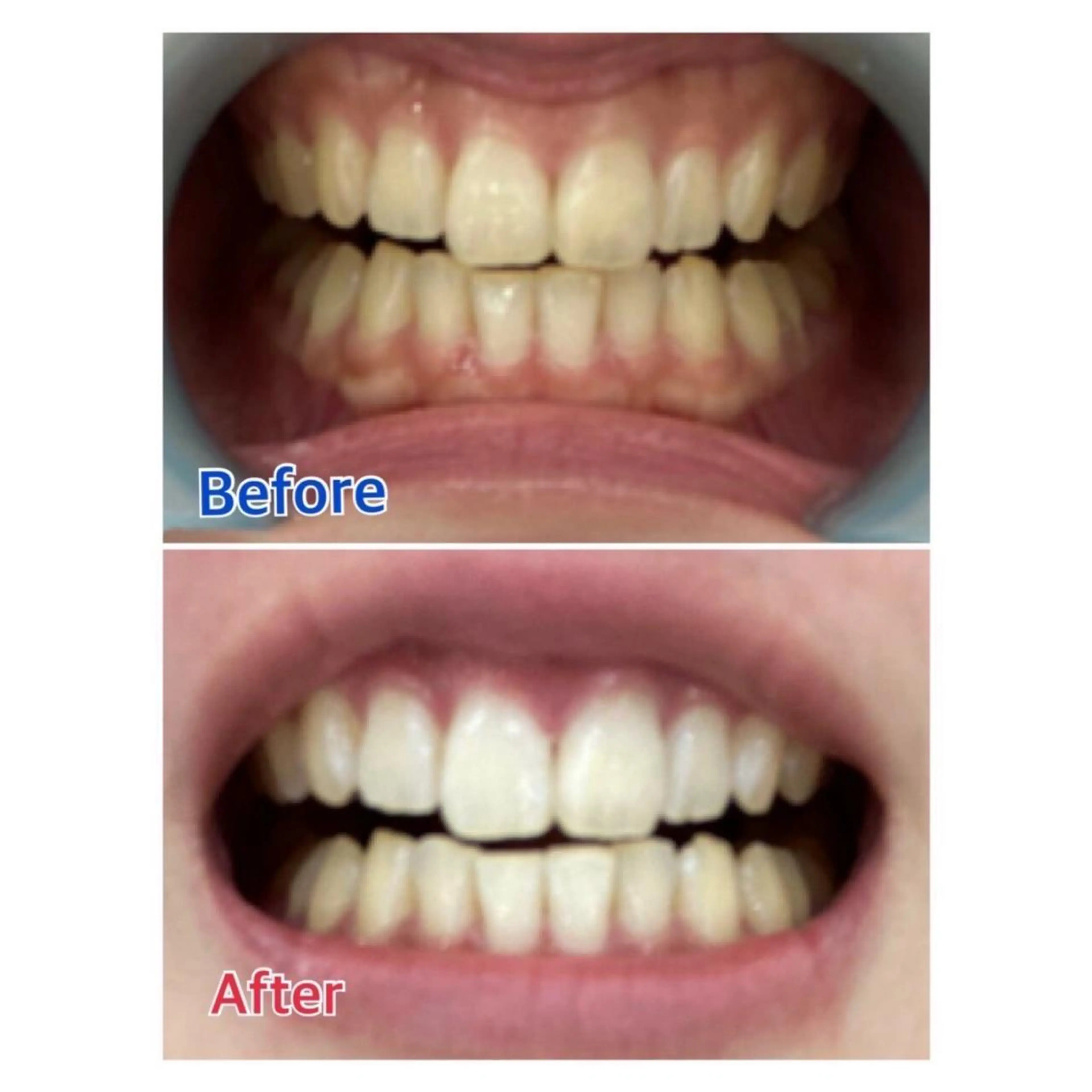 M渋谷 ホワイトニングのエステ・リラクイメージ