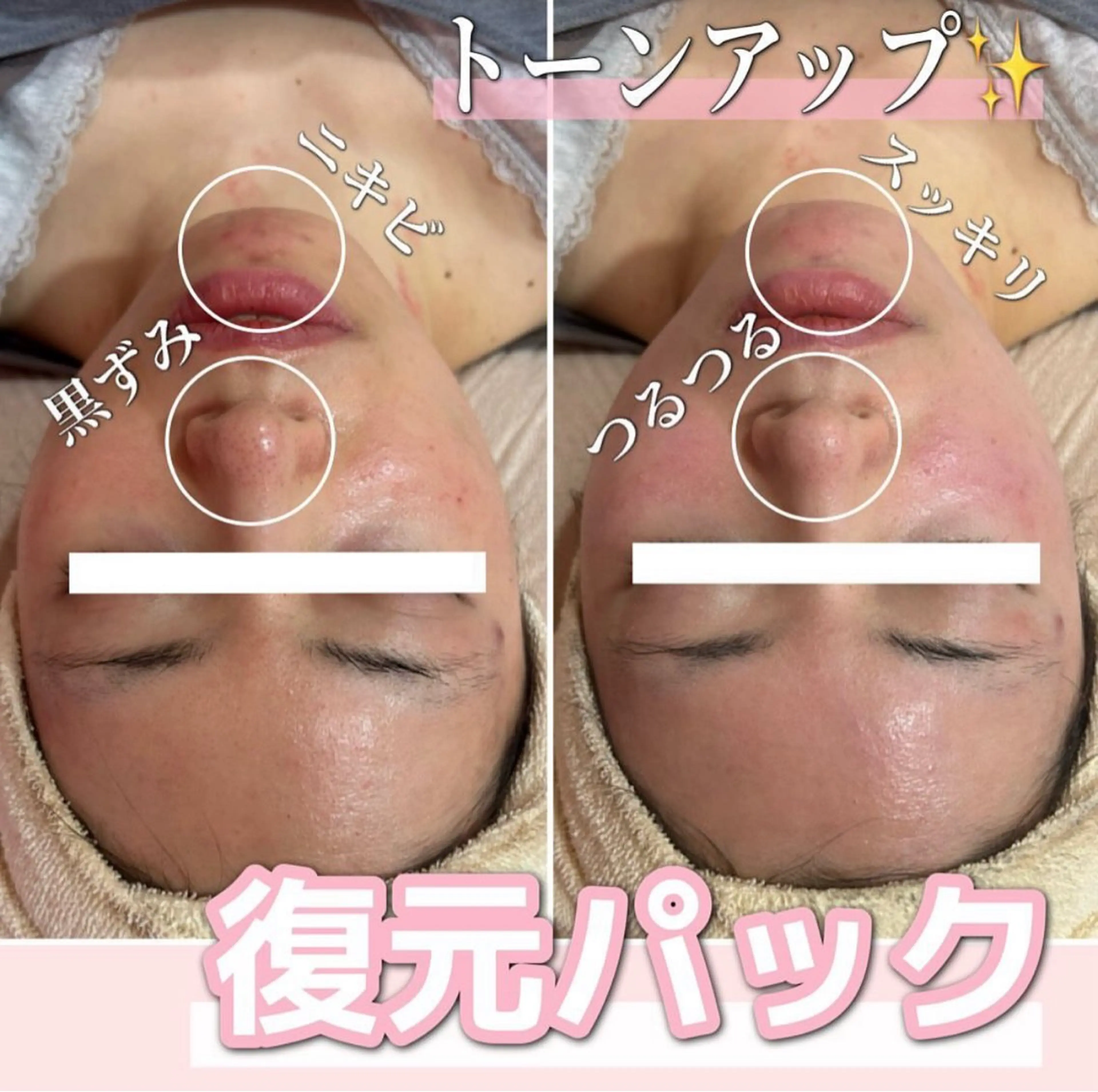 エステ SALON韓国肌管理 東別院のエステ・リラクイメージ