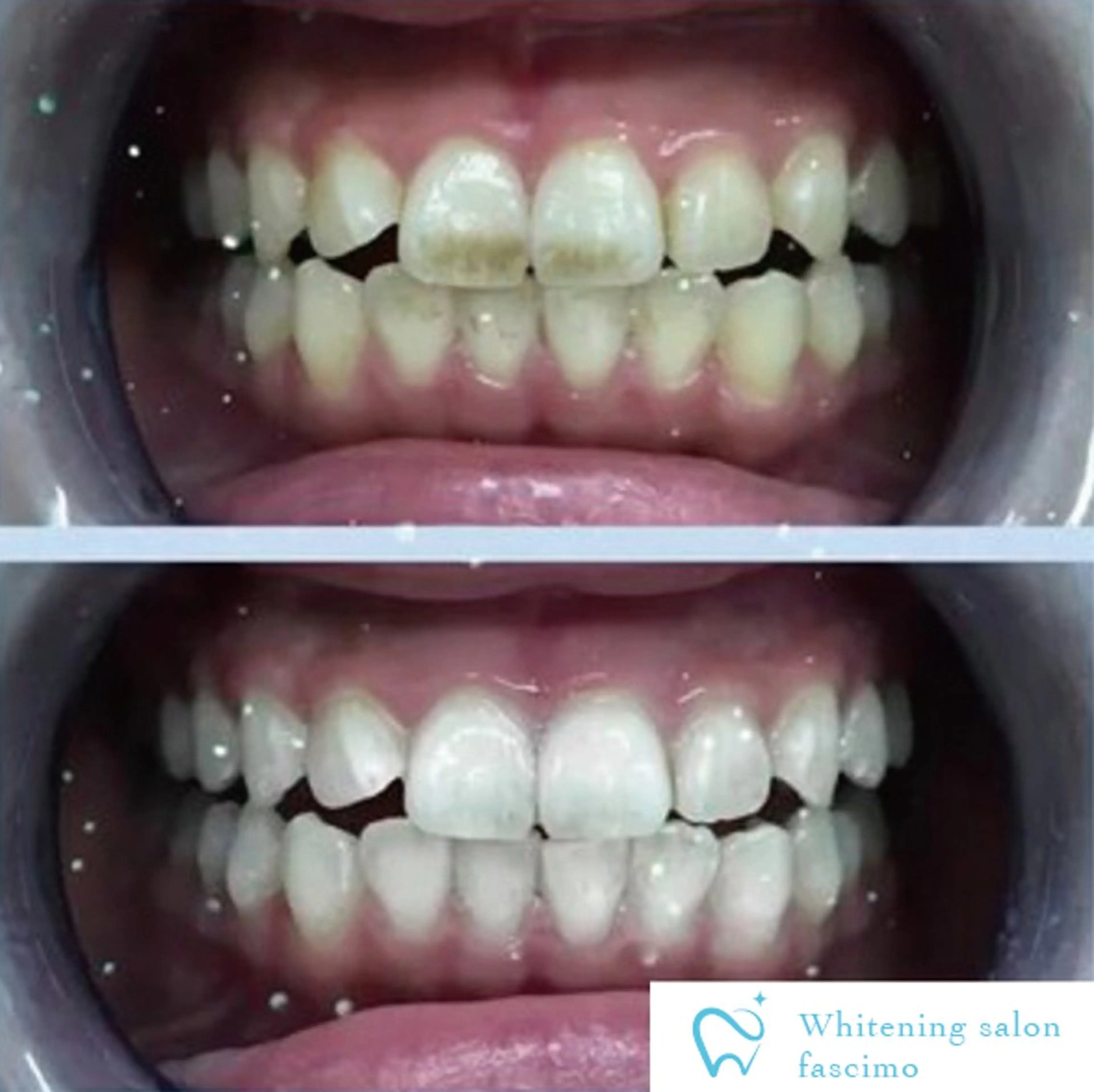 その他 ホワイトニングサロン fascimo新座店のその他イメージ